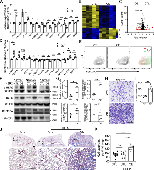 HER2 signaling activation increased fibroblast invasion and fibrosis. (A) The expression of invasive and noninvasive specific genes in HER2 overexpression normal fibroblasts were detected by qRT-PCR (n = 3 per group). (B) Heatmap of the differentially expressed genes of control and HER2 overexpressing normal human lung fibroblasts by bulk RNA-seq. (C) Volcano plot of the top differentially expressed genes between control and HER2 overexpressed normal human lung fibroblasts by bulk RNA-seq. Red dots indicated the genes at Fold_change >0.5 and black dots indicated the genes at Fold_change ≤0.5. (D) Relative expression of invasive and noninvasive specific genes in HER2 overexpression normal fibroblasts detected by bulk RNA-seq (n = 5 per group). (E) Upregulated cell-surface expression of SEMA7A in HER2 overexpression normal lung fibroblasts was confirmed by flow cytometry analysis. (F and G) Western blotting confirmation of the expression of p-HER2, HER2, SEMA7A, and FOXF1 in HER2 overexpression normal human lung fibroblasts (F) and quantification of the densitometry (G; n = 3 per group). GAPDH served as loading control. (H and I) Representative images (H) and index quantification (I; n = 6 per group) of normal lung fibroblast invasion after HER2 overexpression. (J and K) Trichrome staining (J) and hydroxyproline (K; n = 10 per group) of mice lungs receiving HER2 overexpressing and control normal human lung fibroblasts, and age-matched mice were treated with culture medium only. Dash-boxed regions were shown at higher magnification. CTL, control; OE, overexpression. Scale bar: 1 mm (H) and 500 μm (J). Three or four independent experiments were performed on fibroblasts from different patients (A, D, G, I, and K). Data are the mean ± SEM. *, P < 0.05; **, P < 0.01; ***, P < 0.001; ****, P < 0.0001 by Student’s t test (A, D, G, and I) and two-way ANOVA (K). Source data are available for this figure: SourceData F6. Refer to the image caption for details.