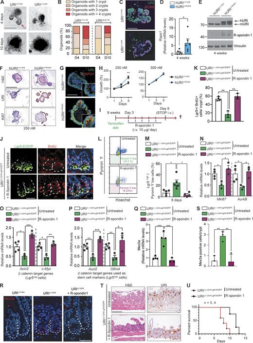 R-spondin supplementation restores Lgr5highISC proliferation. (A) Representative organoids derived from URI(+/+)Int and URI(Δ/Δ)Int mice following 4 and 10 d in culture. Bright-field images are shown. The red arrow represents “crypt-like structures.” (B) Quantification of organoid growth in percentage at indicated time points in culture (n = 3; D, day). (C) Representative co-IF of URI and Sox9 in organoids from URI(+/+)Int and URI(Δ/Δ)Int mice following 10 d of culture. (D) qRT-PCR of Rspo1 mRNA levels in intestines from hURI(+/+)Int and hURI(+/KI)Int mice following 4 wk of doxycycline treatment (n = 6). (E) WB of isolated crypts from hURI(+/+)Int and hURI(+/KI)Int mice following 4 wk of doxycycline treatment. Membranes are blotted with the indicated antibodies. (F) Representative H&E staining and IHC of URI and Ki67 in organoids from hURI(+/+)Int and hURI(+/KI)Int mice under low (250 nM) R-spondin 1 concentration. (G) Representative co-IF of URI and R-spondin 1 in organoids from hURI(+/+)Int and hURI(+/KI)Int mice under low (250 nM) R-spondin 1 concentration. (H) Quantification of organoid growth from hURI(+/+)Int and hURI(+/KI)Int mice at indicated time points under low (250 nM) or normal (500 nM) R-spondin 1 concentration. Results are depicted as percentage of growth related to initial size (n = 3). (I) Experimental design for R-spondin 1 treatment in URI(+/+)Int-Lgr5-EGFP and URI(Δ/Δ)Int-Lgr5-EGFP mice. (J) Representative co-IF for Lgr5-EGFP and BrdU in untreated URI(Δ/Δ)Int-Lgr5-EGFP and R-spondin 1–treated URI(Δ/Δ)Int-Lgr5-EGFP mice following 6 d of tamoxifen treatment. (K) Quantification of Lgr5/BrdU double positive cells per crypt in percentage from J. (L) Representative scatter plot from flow cytometry experiments of quiescent cells in untreated URI(Δ/Δ)Int-Lgr5-EGFP and R-spondin 1–treated URI(Δ/Δ)Int-Lgr5-EGFP mice following 6 d of tamoxifen treatment. (M) Quantification of quiescent cells (Lgr5high and Pyronin Ylow) in untreated URI(+/+)Int-Lgr5-EGFP and URI(Δ/Δ)Int-Lgr5-EGFP and R-spondin 1–treated URI(Δ/Δ)Int-Lgr5-EGFP mice following 6 d of tamoxifen treatment (n = 5, 6, 5) from L. (N–P) qRT-PCR of Mki67 and Aurkb (N), Axin2 and c-Myc (O), and Ascl2 and Olfm4 (P) in sorted Lgr5high cells from URI(+/+)Int-Lgr5-EGFP, untreated URI(Δ/Δ)Int-Lgr5-EGFP, and R-spondin 1–treated URI(Δ/Δ)Int-Lgr5-EGFP mice (n = 4, 3, 3). (Q) qRT-PCR of Mex3a mRNA levels in sorted Lgr5high cells from URI(+/+)Int-Lgr5-EGFP, untreated URI(Δ/Δ)Int-Lgr5-EGFP, and R-spondin 1–treated URI(Δ/Δ)Int-Lgr5-EGFP mice (n = 4, 4, 3). (R) Representative IF for Mex3a in intestinal tissue from URI(+/+)Int-Lgr5-EGFP, untreated URI(Δ/Δ)Int-Lgr5-EGFP, and R-spondin 1–treated URI(Δ/Δ)Int-Lgr5-EGFP mice. (S) Mex3a-positive cell number per crypt from R. (T) Representative H&E staining of URI from untreated URI(Δ/Δ)Int-Lgr5-EGFP and R-spondin 1–treated URI(Δ/Δ)Int-Lgr5-EGFP mice following 8 d of tamoxifen treatment. (U) Kaplan–Meier curve of non-treated URI(Δ/Δ)Int-Lgr5-EGFP (red solid line; n > 3) and R-spondin 1–treated URI(Δ/Δ)Int-Lgr5-EGFP (black solid line; n > 3) mice. Data represent mean ± SEM; *, P < 0.05; **, P < 0.01; ***, P < 0.001, Student’s t test, one-way ANOVA and Mantel–Cox. Scale bars represent 20 µm in J; 50 µm in A, C, and G; and 100 µm in R and T. H&E, IF, and IHC are representative of at least three independent mice. Source data are available for this figure: SourceData F4.