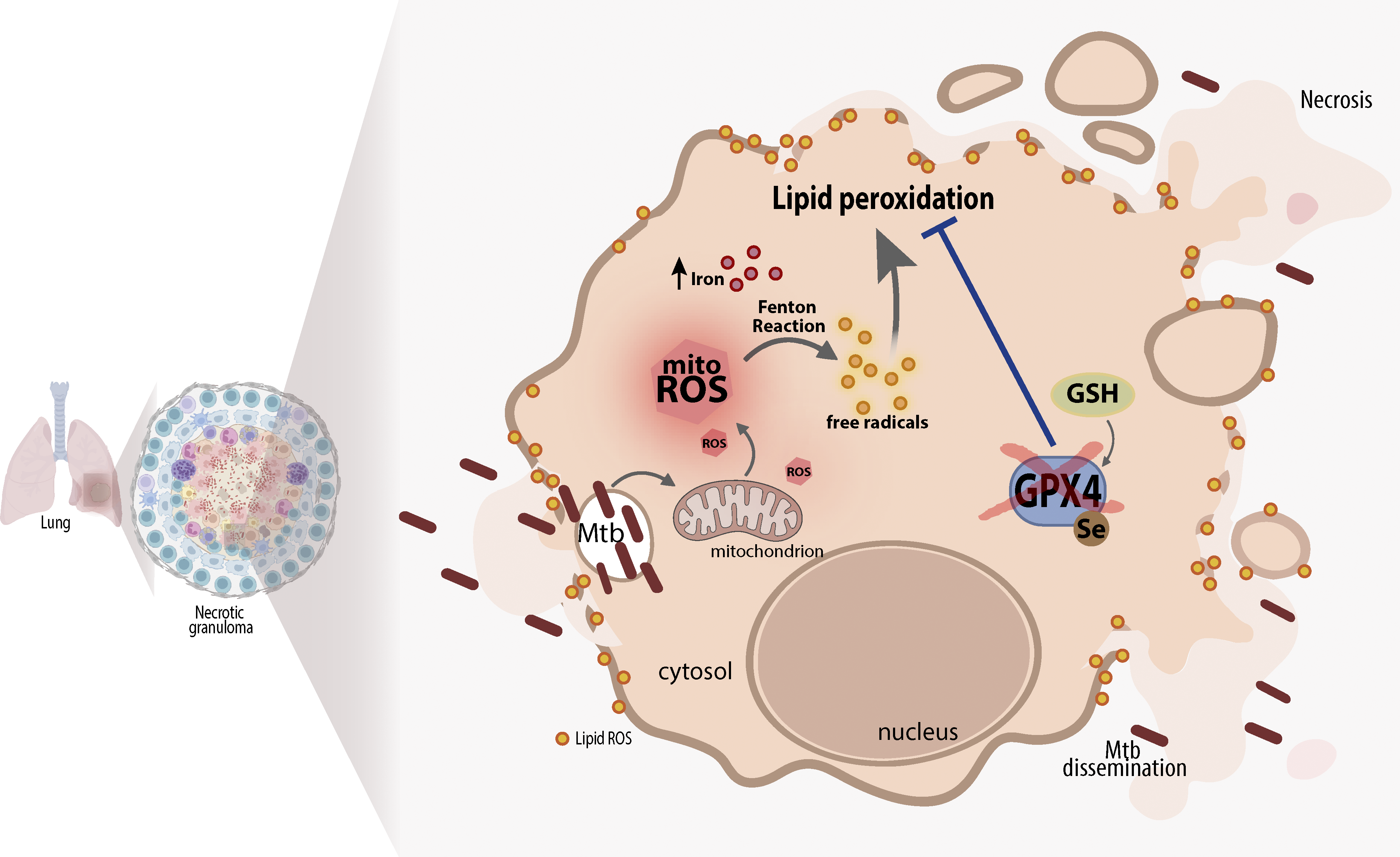 GPX4 regulates cellular necrosis and host resistance in Mycobacterium tuberculosis infection | Journal of Experimental Medicine