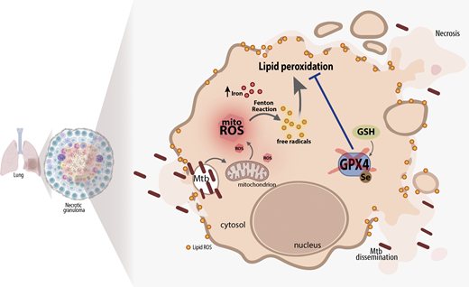 glutathione transferase in mycobacterium Bacterial The Immune Escape Mechanisms of