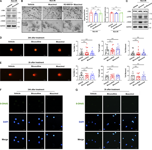 Bicuculline or muscimol had no effect on ROS or DNA damage in organoids in the absence of 5-FU or irradiation treatment. (A) Immunoblots of ATM, p-ATM, and γ-H2AX in the organoids after 2 h with or without bicuculline (1 μM) treatment. (B) Representative images of the organoids 2 d after vehicle, muscimol (1 μM), or KU60019 (1 μM) + muscimol (1 μM) treatment. Scale bar, 500 μm (upper) or 100 μm (bottom). Arrows indicate dead organoids. (C) Immunoblots of ATM, p-ATM, and γ-H2AX in the organoids 1.5 h after treatment as in B. (D and E) Representative images of the comet assay of individual cells isolated from the organoids 24 h (D) or 2 h (E) after indicated treatment. Scale bar, 25 μm. (F and G) Representative immunofluorescence images of 8-OHdG (green) staining of the organoids 24 h (F) or 2 h (G) after indicated treatment. Scale bar, 100 μm. In B, D, and E, values are means ± SEM. n.s., not significant (two-tailed Student’s t test). Data are representative of two (D–G) or three (A–C) independent experiments. Source data are available for this figure: SourceData FS3.