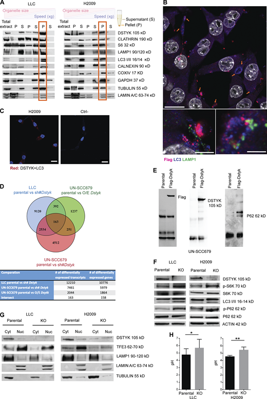 DSTYK is located in autophagosomes and regulates processes related to those vesicles. (A) Subcellular fractionation of LLC and H2009 cells. The following fractions were shown in the Western blot from left to right: total extract; nuclear extract (P3000); cytosolic extract (S3000); large organelle extract (P10000); cytosolic extract without large organelles (S10000); microsomal fraction (P100000); and soluble cytosolic extract (S100000). Different organelle markers were tested to control proper fractionation. (B) Top: Double IF of Flag-Dstyk LLC cells. Flag-DSTYK (magenta) showing co-localization with LC3 (blue). Scale bar: 20 µm. Bottom: Triple IF of Flag-Dstyk LLC cells. Detailed image of autophagosomes: Flag-DSTYK (magenta), LC3 (blue), and LAMP1 (green). Scale bars: 5 and 2 µm. Observed by super-resolution/Airyscan based/confocal microscopy. (C) PLA images of H2009 cells. Left: Red fluorescent dots result from DSTYK+LC3 proteins proximity (maximum distance: 40 nm). Right: Technical negative control. Scale bar: 20 µm. (D) Venn diagram picturing RNAseq analysis. Three RNAseq analyses were carried out to identify the differentially expressed transcripts: LLC comparing parental line vs. silenced (sh#) Dstyk (blue circle), UN-SCC679 line comparing parental vs. overexpression (O/E) Dstyk (green circle), and UN-SCC679 comparing parental vs. silenced (sh#) Dstyk (red circle). Once differentially expressed transcripts were selected (adjusted P value <0.05) in each contrast, all experiments were merged to verify the intersection of the transcripts based on name and the direction. 163 transcripts were finally selected. (E) Immunoprecipitation of Flag-DSTYK in the UN-SCC-679 cell line validating Western blots showing DSTYK binding to P62 protein. (F) Cropped images from the Western blot analysis of autophagy pathway proteins in LLC and H2009 parental and DSTYK-KO cells. (G) Cropped images from the Western blot analysis of lysosomal biogenesis pathway proteins in LLC and H2009 parental and DSTYK-KO cells in cytoplasmic/nuclear fractions. All Western blots show representative results from three independent experiments. (H) Lysosomal pH measurement in LLC and H2009 parental and DSTYK-KO cells. A t test was performed to compared both groups: LLC P value = 0.05; H2009 P value = 0.01. Images shown in A, B, F, G, and H show a representative experiment out of three similarly performed. *, P < 0.05; **, P < 0.01. Source data are available for this figure: SourceData F2.