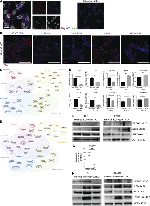 DSTYK is involved in autophagic molecular pathways. (A) Left: Double IF of Flag-Dstyk LLC cells. DSTYK (magenta) showing co-localization with LC3 (blue). Scale bar: 20 µm. Middle: Single channel images correspondent to triple IF of Flag-Dstyk LLC cells. DSTYK (red), LC3 (blue), LAMP1 (green), and nuclei (white). Scale bars: 20 µm. Right: Technical negative control. Scale bars: 10 µm. Observed by super-resolution/Airyscan based/confocal microscopy. (B) Double IF of Flag-Dstyk LLC cells. DSTYK (red) do not co-localize with cellular vesicles markers (blue). Scale bar: 20 µm. (C) Scheme of differentially expressed genes from the RNAseq analysis enriched in the following categories: lysosome, autophagy, mitochondria, oxidative stress, and cytoskeleton. (D) Validation of mRNA expression of candidate genes from the RNAseq analysis in LLC and H2009 parental and CRISPRed cells by quantitative PCR. Analysis was assessed by t test. P values for parental vs. KO comparation were the following: Dstyk in LLC, P < 0.0001 and DSTYK in H2009, P < 0.0001; Lamp1 in LLC, P = 0.001 and LAMP1 in H2009, P < 0.0001; Atp6v0a in LLC, P < 0.0001 and ATP6V0A in H2009, P < 0.03; Nqo1 in LLC, P < 0.0001 and NQO1 in H2009, P < 0.0001; Tomm20 in LLC, P < 0.001 and TOMM20 in H2009, P < 0.03. Three experimental replicates were performed for each experimental condition. (E) Scheme of DSTYK interactor proteins from immunoprecipitation analysis enriched in the following categories: lysosome, autophagy, mitochondria, oxidative stress, and cytoskeleton. (F) Cropped images from Western blot analysis of autophagy pathway proteins in LLC and H2009 parental, DSTYK-KO, and KO treated with rapamycin cells. A representative experiment out of two similarly performed is shown. (G) Glucose levels (mg/dl) in cell culture supernatants of parental H2009 and KO cells. Analysis by t test rendered P = 0.001. Three experimental replicates were performed for each experimental condition. (H) Cropped images from Western blot analysis of autophagy pathway proteins in LLC and H2009 parental, parental treated with chloroquine, and DSTYK-KO cells. *, P < 0.05; **, P < 0.01; ***, P < 0.001. A representative experiment out of two similarly performed is shown. Source data are available for this figure: SourceData FS2.