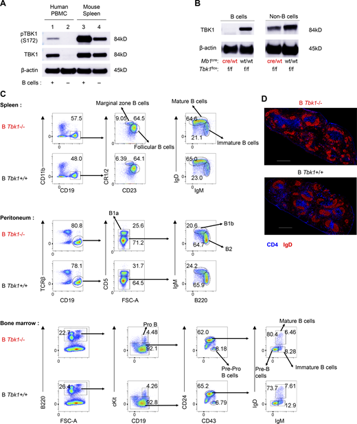 TBK1 expression in B cell and deletion efficiency in B cells and T cells using a Cre-loxP system. (A) Expression and phosphorylation of TBK1 in human B cells from PBMCs and mouse splenic B cells by immunoblotting. (B) Depletion efficiency of TBK1 in splenic B cells was analyzed by immunoblotting. (C) Analysis of subpopulations of B cells in spleen, peritoneum, and bone marrow isolated from B Tbk1−/− and B Tbk1+/+ mice by flow cytometry. FSC-A, forward scatter area. (D) Immunohistochemical staining of B cell zone (red; IgD) and T cell zone (blue; CD4) in the spleens of B Tbk1−/− and B Tbk1+/+ mice. Data are representative of two (A) or five (B) independent experiments or from one experiment with a representative of three independent biological samples (C and D). Scale bars, 500 µm. Source data are available for this figure: SourceData FS2.