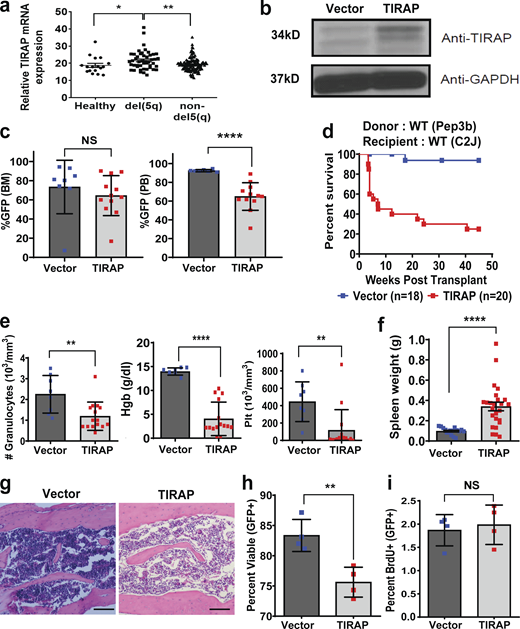 Constitutive expression of TIRAP in HSPCs leads to BMF.(a) TIRAP mRNA expression in CD34+ cells isolated from bone marrow (BM) of healthy controls, a del(5q) MDS patient, and patients with normal diploid copy number at chromosome 5q (from data generated in Pellagatti et al., 2010). (b) WT mouse HSPCs transduced with empty vector (n = 8) or TIRAP (n = 10) were sorted for GFP expression and immunoblotted with antibodies against TIRAP and GAPDH. (c) Bone marrow and peripheral blood (PB) engraftment in WT mice transplanted with vector- (n = 8) or TIRAP-transduced (n = 12) bone marrow cells. (d) Kaplan–Meier survival curves for WT mice reconstituted with WT HSPCs transduced with vector (n = 18) or TIRAP (n = 20); P < 0.0001. Data pooled from five separate transplants. (e) Granulocyte, hemoglobin (Hgb), and platelet (Plt) counts in the peripheral blood from TIRAP-transduced (n = 15) and vector-transduced (n = 8) WT mice at experimental end point. (f) Spleen weights of vector- (n = 8) and TIRAP-transplanted (n = 15) WT mice at experimental end point. (g) Representative images of H&E-stained bone marrow sections showing bone marrow hypocellularity in TIRAP-transplanted WT mice compared with vector transplantation. Scale bar: 100 µm for 10× magnification. (h) Percentage of viable (Annexin V−/PI−) HSPCs from vector-transplanted (n = 4) or TIRAP-transplanted (n = 4) WT mice 3–4 wk after transplant. (i) BrdU incorporation was measured in WT BM transduced with TIRAP (n = 4) or vector (n = 4) collected at end point after transplantation. *, P ≤ 0.05; **, P ≤ 0.01; ****, P ≤ 0.0001. Data pooled from two to four independent experiments (c–i). Source data are available for this figure: SourceData F1. Refer to the image caption for details.