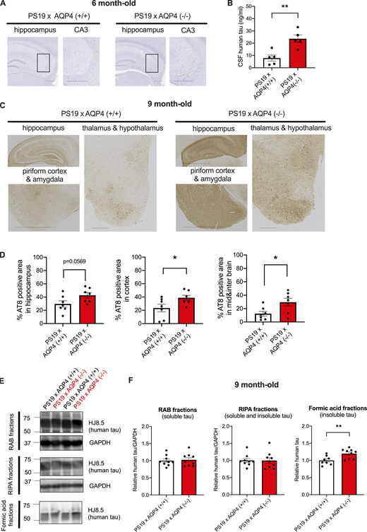 AQP4 deficiency markedly exacerbates tau pathology in PS19 mice. (A) Representative images of AT8 staining in 6-month-old mice with hematoxylin staining. Scale bars, 300 μm. (B) CSF human tau levels in 6-month-old mice. Unpaired two-tailed t test; **, P < 0.01. n = 5/group. (C) Representative images of AT8 staining in 9-month-old mice. Scale bars, 1 mm for the hippocampus, piriform cortex, and amygdala and 300 μm for the thalamus and hypothalamus. (D) Quantification of the percentage of area covered by AT8 staining in 9-month-old mice. Unpaired two-tailed t test; *, P < 0.05. n = 7/group. (E) Representative immunoblots probing for human tau and GAPDH in RAB, RIPA, and formic acid fractions of 9-month-old PS19 × AQP4 (+/+) and PS19 × AQP4 (−/−) mice (in kD). (F) Quantification of immunoblot probing for human tau in RAB, RIPA, and formic acid fractions of 9-month-old PS19 × AQP4 (+/+) (n = 8 or 9) and PS19 × AQP4 (−/−) mice (n = 9). Unpaired two-tailed t test; **, P < 0.01. Source data are available for this figure: SourceData F3. Refer to the image caption for details.
