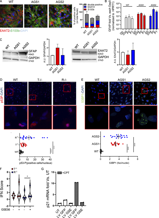 AGS patient–derived and KO iPSCs efficiently differentiate into proinflammatory astrocytes and spontaneously activate DNA damage responses. iPSC-derived proinflammatory astrocytes from healthy control (WT) or patients harboring mutations in TREX1 (AGS1) or RNASEH2B (AGS2) were analyzed. (A) Percentages of S100b- and EAAT2-expressing and double-positive cells were measured by IF and quantified. One representative image per genotype is shown. Five fields from three slides of two independent differentiation experiments were acquired. Scale bar, 50 µm. (Mean ± SEM; n = 2 independent experiments.) (B) GFAP astrocyte marker was detected by gene expression in AGS patient–derived clones and WT at passage 1 after the iPSC-derived astrocyte enrichment step and expressed as fold difference vs. day 0, normalized on HPRT1 housekeeping gene. (Mean ± SEM; n = 3 independent experiments.) (C) Expression and ImageJ quantification of the astrocyte markers EAAT2 and GFAP by WB. One representative gel is shown. (Mean ± SEM; n = 3 independent experiments.) (D) IF of WT and KO iPSC–derived proinflammatory astrocytes stained for phosphorylated p53, quantified by measuring area intensity normalized on number of nuclei. Each dot corresponds to one field from three slides of four independent differentiations. Scale bar, 50 µm. (Mean ± SEM; n = 4 independent experiments; one-tailed Mann–Whitney U test; ****, P < 0.0001.) (E) IF of AGS patient–derived iPSC-derived proinflammatory astrocytes stained for 53BP1, quantified by cell profiler. Each dot corresponds to one field from three slides of three independent differentiations. (Mean ± SEM; n = 3 independent experiments; one-tailed Mann–Whitney U test; ****, P < 0.0001.) Scale bar, 50 µm. (F) Violin plot showing the distribution of IFN scores calculated from the median FC of six ISGs in T−/− and R−/− KO cells transduced with a lentiviral vector expressing GSE56. (n = 2 independent experiments; Wilcoxon rank-sum test; *, P < 0.05.) (G) p21 mRNA levels were detected by gene expression in astrocytes upon transduction with lentiviral vector expressing GFP (LV GFP) or GSE (LV GSE56) in the presence or not of Camptothecin (CPT), a topoisomerase inhibitor. Data are expressed as fold vs. untransduced cells (UT) and normalized to HPRT1 housekeeping gene. (Mean ± SD; n = 2 technical replicates.) Source data are available for this figure: SourceDataFS4. Refer to the image caption for details.