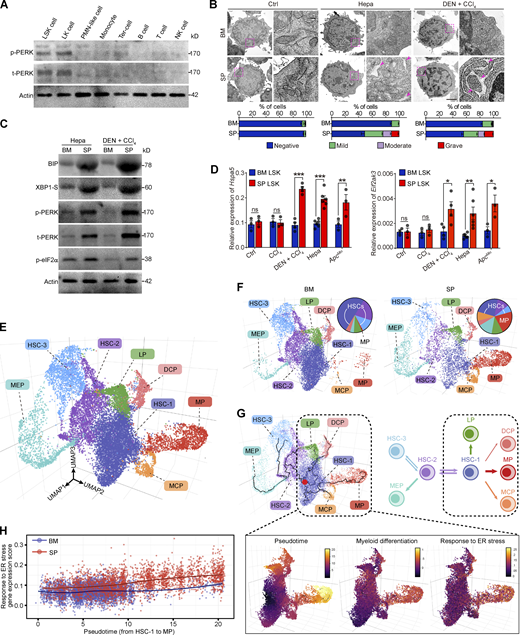 Robust ER stress response with PERK activation is concomitant with early myeloid commitment in splenic HSPCs. (A) IB analysis of PERK expression in different splenic subsets from Hepa mice. t, total. (B) Representative microphotographs of LSK cell morphology and the proportions of cells with different degrees of ER dilation (lower panel, n = 2 samples per group, with cells pooled from 25–80 mice). Arrows denote dilated ER. Scale bar, 2 μm. (C) IB analysis of BIP, XBP1-S, PERK, and p-eIF2α levels in BM and spleen (SP) LSK cells from Hepa mice. (D)Hspa5 and Eif2ak3 mRNA expression in BM and SP LSK cells from control, CCl4-treated, CCl4 + DEN–treated, Hepa, and ApcMin mice (n = 3–6 samples per group, with cells pooled from three to five mice). Values are presented relative to Actb mRNA expression. (E) 3D UMAP graph of single LSK cells from Hepa mice. LP, lymphoid-biased progenitor; DCP, dendritic cell progenitor; MCP, mast cell progenitor. (F) Proportions of eight clusters in BM and SP LSK cells. (G) Single-cell trajectory analysis (upper panel) of LSK cells. A root node (red dot) in the HSC-1 cluster was defined as the starting point of differentiation. (H) Correlation between genes associated with the ER stress response and genes involved in myeloid commitment. Error bars indicate the means ± SEM. Statistics: Two-way ANOVA corrected by Bonferroni’s test. *, P < 0.05; **, P < 0.01; ***, P < 0.001. Data are from one experiment with cells pooled from 15 mice (E–H) or two independent experiments (B and D) or are representative of two experiments with cells pooled from 5 to 10 mice (A and C). Source data are available for this figure: SourceDataF2.