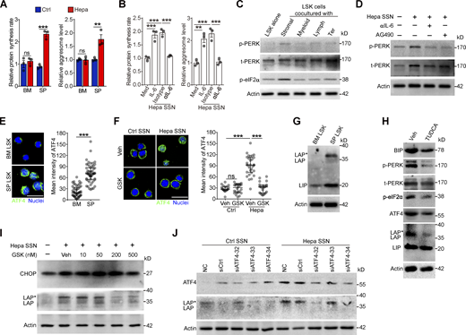 Tumor-associated splenic stroma induces ER stress responses in HSPCs and activates PERK–ATF4–C/EBPβ signaling. (A and B) Protein synthesis rates and levels of protein aggregates in BM and spleen (SP) LSK cells from control and Hepa mice (A, n = 3 mice per group) or in LSK cells cultured with Hepa mouse-derived SSN (Hepa SSN; B). (C) IB analysis of PERK and p-eIF2α levels in LSK cells cocultured with the indicated splenic cell types. (D) Effects of Hepa SSN, anti–IL-6 neutralizing antibody (αIL-6), and STAT3 inhibitor (AG490) on PERK expression in LSK cells. (E and F) Expression and distribution of ATF4 in LSK cells from Hepa mice (E) or in cultured LSK cells with the indicated treatments (F). Scale bar, 25 μm. Veh, vehicle. (G) IB analysis of the expression of the C/EBPβ isoforms (LAP*, LAP, and LIP) in BM and splenic LSK cells from Hepa mice. (H) IB analysis of ER stress response signaling in splenic LSK cells from Hepa mice. Mice were treated with TUDCA or vehicle via spleen-targeted micro-osmotic pump delivery. (I) IB analysis of CHOP and C/EBPβ isoforms in LSK cells under the indicated conditions. (J) IB analysis of ATF4 and C/EBPβ isoforms in LSK cells with indicated treatments. Error bars indicate the means ± SEM (A and B) or medians and IQRs (E and F). Statistics: Mann–Whitney U test (E and F); one-way ANOVA corrected by Tukey’s test (B), two-way ANOVA corrected by Bonferroni’s test (A). **, P < 0.01; ***, P < 0.001. In E and F, dots are representative of 20–50 cells from two samples per group. Data are from two independent experiments (A) or three independent experiments (n = 3 samples) with cells pooled from three mice (B, E, and F) or are representative of two independent experiments (C, D, and G–J). t, total. Source data are available for this figure: SourceDataF4.