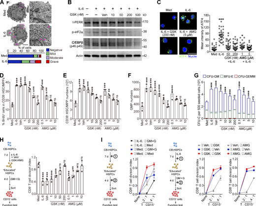 Activation of PERK–ATF4–C/EBPβ signaling is essential for human HSPC differentiation into MDSCs. (A) Representative microphotographs of CB-HSPC morphology. Arrows denote dilated ER. Scale bar, 2 μm; Med, SFEM supplemented with SCF, TPO, and Flt3L. (B) IB analysis of total PERK (t-PERK), C/EBPβ, and p-eIF2α levels in CB-HSPCs cultured under the indicated conditions. (C) Expression and distribution of ATF4 in cultured human HSPCs. Scale bar, 25 μm. (D) Effects of PERK inhibitors on CD34+CD38− HSC/MPP proliferation. (E and F) Numbers of HSCs/MPPs (E) and GMPs (F) after 72 h of culture of 500 lin−CD34+CD38− HSCs/MPPs. (G) CFU-C activity in the cultured HSPCs on day 7. (H and I) Suppressive activity of CD15+ myeloid cells generated from CD34+ HSPCs under the indicated conditions. GM, GM-CSF; G, G-CSF. Error bars indicate means ± SEM (A and D–I) or median and IQR (C). Statistics: Kruskal–Wallis test (C); one-way (D–F and H) or two-way (G) ANOVA corrected by Dunnett’s test. *, P < 0.05; **, P < 0.01; ***, P < 0.001. Data are from three independent experiments (n = 3 samples per group) or are representative of three independent experiments (B and C). Source data are available for this figure: SourceDataF7.