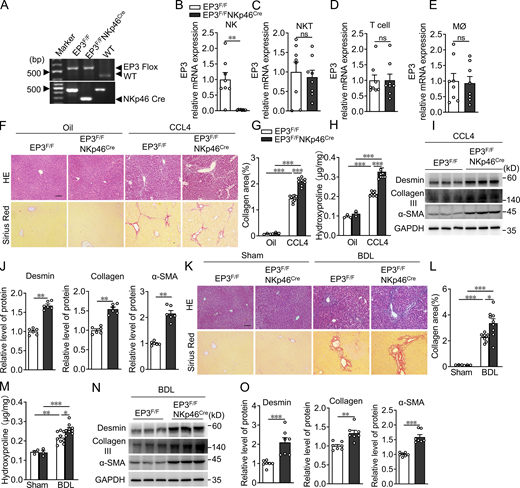 NK cell–specific deletion of EP3 aggravates CCL4- or BDL-induced LF in mice. (A) Genotyping of NK cell–specific EP3-deleted mice by PCR of genomic DNA extracted from the tail biopsies. (B–E) Quantification of EP3 expression in NK cells (B), NKT cells (C), T cells (D), and macrophages (E) from EP3F/F and EP3F/FNKp46Cre mice (n = 8 per group). (F) H&E and Sirius red staining of CCL4-treated liver from EP3F/F and EP3F/FNKp46Cre mice. Scale bars, 100 μm. (G) Quantification of Sirius red–stained collagen in F (oil, n = 3 per group; CCL4, n = 8 per group). (H) Quantification of hepatic hydroxyproline in CCL4-treated liver from EP3F/F and EP3F/FNKp46Cre mice (oil, n = 3 per group; CCL4, n = 8 per group). (I) Western blot analysis of protein levels of α-SMA, collagen III, and desmin in CCL4-treated liver from EP3F/F and EP3F/FNKp46Cre mice. (J) Quantification of protein levels in I (n = 6 per group). (K) H&E and Sirius red staining of BDL liver from EP3F/F and EP3F/FNKp46Cre mice. Scale bars, 100 μm. (L) Quantification of Sirius red–stained collagen in K (oil, n = 3 per group; CCL4, n = 9 per group). (M) Quantification of hepatic hydroxyproline in BDL-treated liver from EP3F/F and EP3F/FNKp46Cre mice (oil, n = 3 per group; CCL4, n = 9 per group). (N) Western blot analysis of protein levels of α-SMA, collagen III, and desmin in BDL liver from EP3F/F and EP3F/FNKp46Cre mice. (O) Quantification of protein levels in N (n = 7 per group). Data are representative of two independent experiments (A–E, F–J, and K–O). Data represent mean ± SEM. Statistical significance was evaluated by Mann–Whitney U test (B, C, D, E, J, and O) and two-way ANOVA followed by Tukey’s test for multiple comparisons (G, H, L, and M). *, P < 0.05; **, P < 0.01; ***, P < 0.001. Source data are available for this figure: SourceData F2. Refer to the image caption for details.