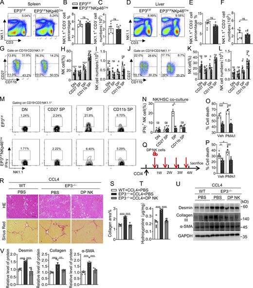Adoptive transfer of DP NK cells rescues the aggravated LF induced by CCL4 in EP3-deficient mice. (A–C) Representative flow cytometric profiles (A), percentages (B), and numbers (C) of splenetic NK1.1+ NK cells from EP3F/F and EP3F/FNKp46Cre mice (n = 8 per group). (D–F) Representative flow cytometric profiles (D), percentages (E), and numbers (F) of hepatic NK1.1+ NK cells from EP3F/F and EP3F/FNKp46Cre mice (n = 8–9 per group). (G–I) Representative flow cytometric profiles (G), percentages (H, n = 10 per group), and numbers (I, n = 5–6 per group) of four-stage (DN, CD27 SP, DP, and CD11b SP) development of splenic NK cells (gated as NK1.1+CD3−CD19−) from EP3F/F and EP3F/FNKp46Cre mice. (J–L) Representative flow cytometric profiles (J), percentages (K, n = 6–7 per group), and numbers (L, n = 7–10 per group) of four-stage development of hepatic NK cells (gated as NK1.1+CD3−CD19−) from EP3F/F and EP3F/FNKp46Cre mice. (M and N) Representative flow cytometry plots (M) and frequency (N) of IFN-γ–positive NK cells in the four developmental stages from spleens of EP3F/F and EP3F/FNKp46Cre mice following stimulation by early activated HSCs (n = 3–5 per group). (O and P) Cytotoxicity of DP NK cells from spleens (O) and livers (P) of EP3F/F and EP3F/FNKp46Cre mice against activated mouse HSCs (NK cells:HSCs = 10:1) with or without PMA (50 ng/ml)/ionomycin (0.5 μg/ml) prestimulation for 4 h (n = 5–7 per group). (Q) Schematic representation of the experimental design for adoptive transfer. (R) H&E and Sirius red staining of CCL4-treated liver from EP3−/− mice after adoptive transfer of DP NK cells. Scale bars, 100 μm. (S) Quantification of Sirius red–stained collagen in R (n = 6–8 per group). (T) Quantification of hepatic hydroxyproline in CCL4-treated liver from EP3−/− mice after adoptive transfer of DP NK cells (n = 6–8 per group). (U) Western blot analysis of protein levels of α-SMA, collagen III, and desmin in CCL4-treated liver from EP3−/− mice after adoptive transfer of DP NK cells. (V) Quantification of protein levels in U (n = 5–6 per group). Data are representative of two independent experiments (A–L, M–P, and R–V). Data represent mean ± SEM. Statistical significance was evaluated with Mann–Whitney U test (B, C, E, F, H, I, K, L, and N), two-way ANOVA followed by Tukey’s test for multiple comparisons (O and P), and one-way ANOVA followed by Tukey’s test for multiple comparisons (S, T, and V). *, P < 0.05; **, P < 0.01; ***, P < 0.001. Source data are available for this figure: SourceData F3.