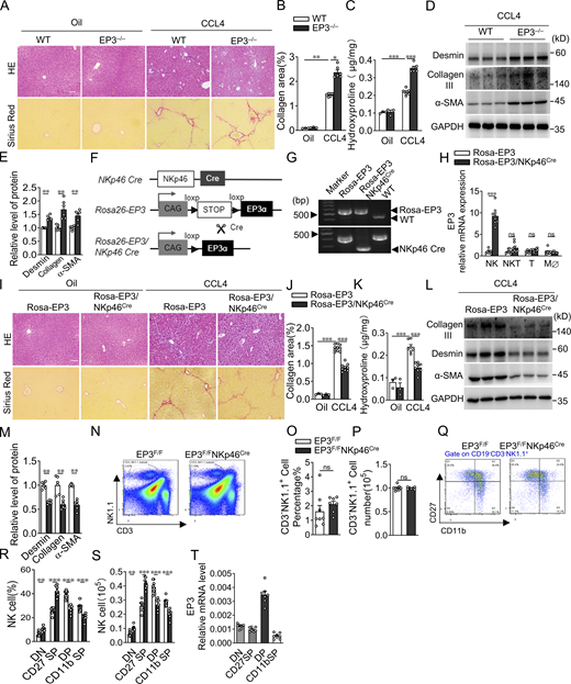 EP3 is required for NK cell–mediated protection against LF in mice. (A) H&E and Sirius red staining of CCL4-treated livers from WT and EP3−/− mice. Scale bars, 100 μm. (B) Quantification of Sirius red–stained collagen in A (oil, n = 3 per group; CCL4, n = 6 per group). (C) Quantification of hepatic hydroxyproline in CCL4-treated liver from WT and EP3−/− mice (oil, n = 3 per group; CCL4, n = 6 per group). (D) Western blot analysis of protein levels of α-SMA, collagen III, and desmin in CCL4-treated livers from WT and EP3−/− mice. (E) Quantification of protein levels in D (n = 6 per group). (F) Schematic diagram for the generation of Rosa-EP3/NKp46Cre mice. (G) Genotyping of NK cell–specific EP3 overexpressed mice by PCR of genomic DNA extracted from the tail biopsies. (H) Quantification of EP3 expression in NK cells, NKT cells, T cells, and macrophages from Rosa-EP3 and Rosa-EP3/NKp46Cre mice (n = 8 per group). (I) H&E and Sirius red staining of CCL4-treated liver from Rosa-EP3 and Rosa-EP3/NKp46Cre mice. Scale bars, 100 μm. (J) Quantification of Sirius red–stained collagen in I (oil, n = 3 per group; CCL4, n = 9–10 per group). (K) Quantification of hepatic hydroxyproline in CCL4-treated liver from Rosa-EP3 and Rosa-EP3/NKp46Cre mice (oil, n = 3 per group; CCL4, n = 7–8 per group). (L) Western blot analysis of protein levels of α-SMA, collagen III, and desmin in CCL4-treated liver from Rosa-EP3 and Rosa-EP3/NKp46Cre mice. (M) Quantification of protein levels in L (n = 6 per group). (N–P) Representative flow cytometric image (N), percentages (O), and numbers (P) of NK1.1+ hepatic NK cells, depicted for EP3F/F and EP3F/FNKp46Cre mice with CCL4 treatment for 10 d (n = 7–8 per group). (Q–S) Representative flow cytometric image (Q), percentages (R), and numbers (S) of four-stage development of hepatic NK cells, depicted for EP3F/F and EP3F/FNKp46Cre mice challenged with CCL4 (n = 7–8 per group). (T) Relative expression of EP3 in NK subsets (n = 7–8 per group). Data are representative of two independent experiments (A–E and G–T). Data represent mean ± SEM. Statistical significance was evaluated by two-way ANOVA followed by Tukey’s test for multiple comparisons (B, C, J, and K) and Mann–Whitney U test (E, H, M, R, and S). *, P < 0.05; **, P < 0.01; ***, P < 0.001. Source data are available for this figure: SourceData FS1. Refer to the image caption for details.