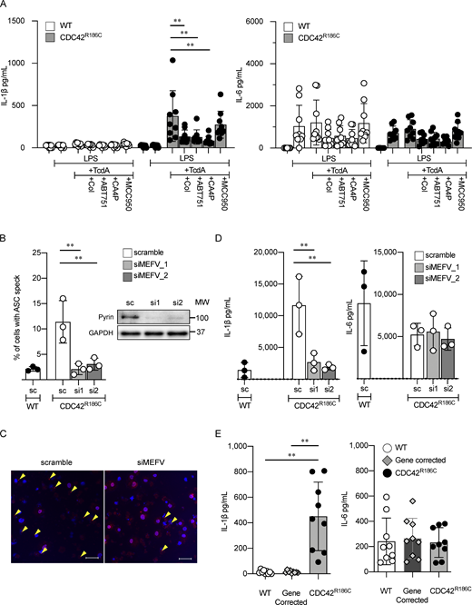 CDC42R186Cinduces pyrin inflammasome hyperactivation. (A) IL-1β and IL-6 release from iPS-MLs derived from Patient 1 and healthy controls stimulated with LPS and TcdA in the presence or absence of pyrin and NLRP3 inhibitors. (B–D) Ratio (B) and images (C) of ASC speck formation, and release (D) of IL-1β and IL-6 from Patient 1–derived iPS-MPs in which MEFV was knocked down by siRNA. Immunoblot images in B show the effects of siRNAs. (E) IL-1β and IL-6 release from Patient 1–derived iPS-MLs, mutation-corrected Patient 1–derived iPS-MLs, and iPS-MLs from healthy controls stimulated with LPS + TcdA. The results in A and E are from three experiments with three clones, and representative results of three independent experiments with three clones are shown for B and D. Statistical significance was determined by Dunnett test in A, B, and D, and by Steel–Dwass test in E. **, P < 0.01. Scale bars, 50 μm. Source data are available for this figure: SourceData F2. Refer to the image caption for details.