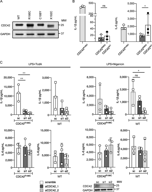 Immunoblot analysis of CDC42 C-terminal variants, cytokine production from iPS-MLs carrying CDC42R66G, and the effect of CDC42 silencing on cytokine production from CDC42WTand CDC42R186CiPS-MLs. (A) CDC42 C-terminal variants were transiently transfected into HEK293T cells, and their expression levels were evaluated by Western blot analysis. (B) iPSCs carrying CDC42R66G were generated by manipulating WT-iPSCs by single-base editing and iPS-MPs were differentiated. Cells were stimulated with LPS + TcdA and the production of IL-1β and IL-6 was evaluated. (C) iPS-MLs from Patient 1 and healthy controls were treated with scramble or CDC42 siRNA and the release of IL-1β and IL-6 was monitored in response to LPS + TcdA or LPS + nigericin stimulation. Immunoblot images at the bottom show the effects of siRNAs. Representative results of (A) two independent experiments with similar results, and (B and C) two independent experiments with three clones, are shown. Statistical significance was determined by Mann–Whitney’s U test (B) and by Dunnet test (C). *, P < 0.05; **, P < 0.01; ns, not significant. Source data are available for this figure: SourceData FS2.