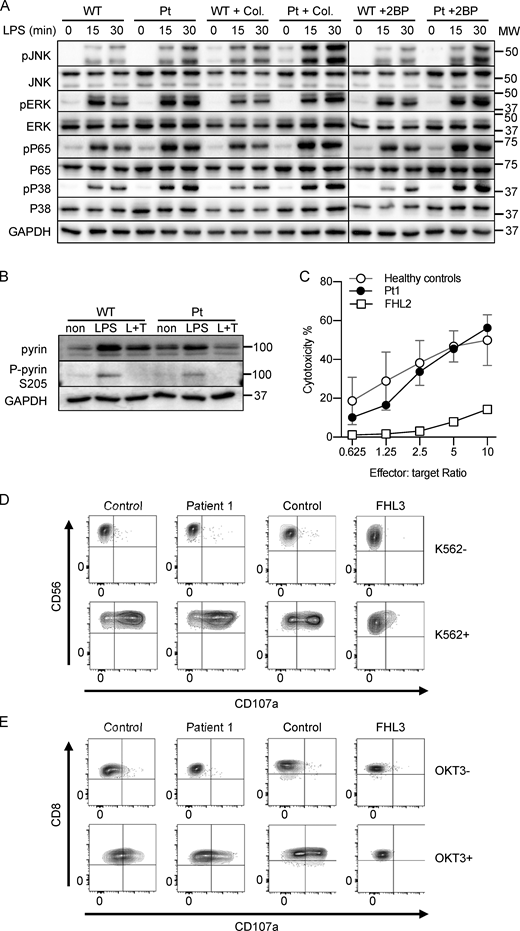 Analyses of NF-κB signaling in iPS-MLs and cytolytic and degranulation activity of NK cells and CTLs from Patient 1. (A and B) Immunoblot of JNK, ERK, P65, P38 (A) and pyrin (B) molecules and their phosphorylated forms in iPS-MLs from Patient 1 and a healthy control in response to LPS (A) and LPS ± TcdA (B) stimuli. (C) Cytolytic activity of activated NK cells derived from healthy controls, Patient 1, and a FHL2 patient. (D and E) Degranulation of activated NK cells (D) and CTLs (E) derived from healthy controls, Patient 1, and a FHL3 patient. Representative results of three (A and B) and two (C–E) independent experiments with similar results are shown. FHL, familial hemophagocytic lymphohistiocytosis. Source data are available for this figure: SourceData FS3.