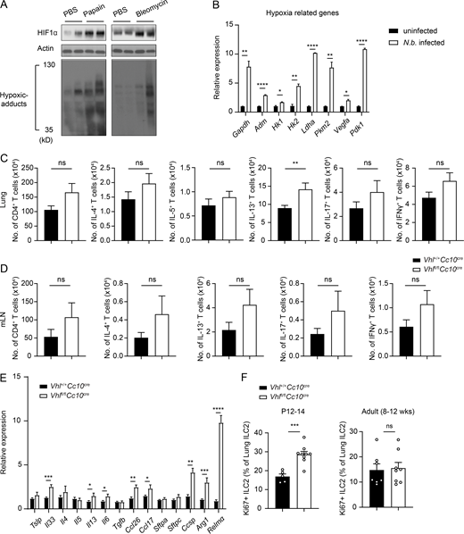 Phenotypic analysis of VHL-deficient mice at resting state. (A) Immunoblotting analysis of HIFα induction in whole-lung lysates from control and challenged mice. Each lane represents an individual animal. (B) Expression of hypoxia-related genes increased by N.b. infection in the lung. qPCR analysis was performed to determine mRNA levels of the indicated genes. n = 2–3 mice/group. Data are representative of two independent experiments. (C and D) CD4+ T cells in lung and mLN from WT and VHL cKO were assessed by flow cytometry. (E) Expression of type 2 related genes induced by VHL deficiency. RT-qPCR analysis was performed to determine mRNA levels of the indicated genes. Data are pooled from at least three independent experiments. n = 3–5 mice/group pooled from more than three independent experiments. (F) Percentage of Ki67+ ILC2s in the lung at the indicated age. (B–F)n = 2–5 mice/group pooled from two independent experiments. Error bars indicate SEM; *, P < 0.05; **, P < 0.01; ***, P < 0.001; ****, P < 0.0001 (Student’s t test). Source data are available for this figure: SourceData FS1.