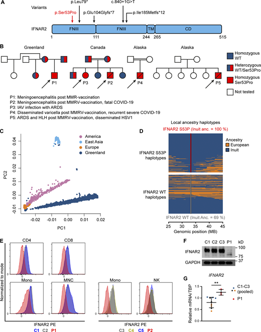 Identification of a novel homozygous IFNAR2 variant leading to IFNAR2 deficiency. (A) IFNAR2 protein sequence with known deleterious variants marked. (B) Pedigrees of affected individuals originating from Greenland (P1), Canada (P2 and P3), and Alaska (P4 and P5). Double lines refer to consanguinity. (C) Principal component analysis of 4,630 Greenlandic individuals combined with three super populations from the 1000 Genomes Project. (D) Local ancestry haplotypes of admixed and p.Ser53Pro IFNAR2 heterozygous Greenlandic individuals colored according to ancestry. Each heterozygous individual is represented with two haplotypes, one for the p.Ser53Pro haplotype (top) and one for the WT haplotype (bottom). The fraction of Inuit ancestry of the WT and p.Ser53Pro haplotype is estimated at the location of the variant. (E) IFNAR2 cell surface expression analyzed by flow cytometry in PBMCs and distinct cell subsets of healthy controls (C1–C5) and patients (P1 and P2). Representative of a single experiment in P1 and P2 PBMC. (F) Immunoblotting showing IFNAR2 expression in whole-cell lysates of PBMCs from P1 compared to three healthy controls (C1–C3). GAPDH was used as loading control. Not repeated due to limited patient material. (G) RT-qPCR of whole-cell RNA lysates of PBMCs evaluating IFNAR2 mRNA levels relative to TBP for P1 compared to three healthy controls (pooled, mean ± SD of n = 3 biological replicates; **, P < 0.01, Welch’s t test). Representative of a single experiment in P1 PBMC. Source data are available for this figure: SourceData F1. Refer to the image caption for details.