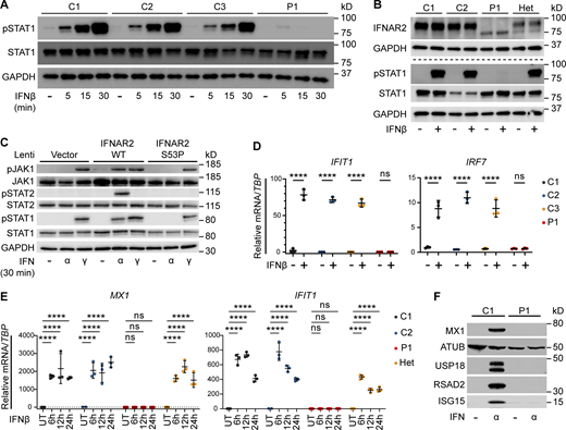 Defective signaling and ISG induction downstream of IFNAR2 p.Ser53Pro. (A) PBMCs from P1 and three healthy controls (C1–C3) were treated with IFNβ 100 IU/ml for 5, 15, or 30 min. Whole-cell lysates were harvested for Western blotting for the visualization of pSTAT1, STAT1, and GAPDH, which was used as the loading control. Not repeated due to limited patient material. (B) Primary dermal fibroblasts from P1, two healthy controls (C1 and C2), and the heterozygous mother of P1 (Het) were treated with IFNβ 100 IU/ml for 30 min. Whole-cell lysates were harvested for immunoblotting and the visualization of IFNAR2, STAT1, pSTAT1, and GAPDH as the loading control. One representative immunoblot of n = 3 independent experiments is shown. (C) Primary IFNAR2−/− dermal fibroblasts reconstituted with lentiviruses expressing GFP, WT, or p.Ser53Pro IFNAR2 were treated with IFNα2b or IFNγ 1,000 IU/ml for 30 min. Whole-cell lysates were harvested for immunoblotting and visualization of pJAK1, JAK1, pSTAT2, STAT2, STAT1, pSTAT1, and GAPDH as the loading control. One representative immunoblot of n = 3 independent experiments is shown. (D) PBMCs from P1 and three healthy controls (C1–C3) were treated with IFNβ 100 IU/ml for 6 h. Total RNA was purified for RT-qPCR of IFIT1 and IRF7 relative to TBP (mean ± SD of n = 3 independent experiments; ****, P < 0.0001, ns, non-significant; two-way ANOVA with Šidák’s test for multiple comparisons). (E) Primary dermal fibroblasts from P1, two healthy controls (C1 and C2), and the mother of P1 (Het) were treated with IFNβ 100 IU/ml for 6–24 h. Total RNA was purified for RT-qPCR of MX1 and IFIT1 relative to TBP (mean ± SD of n = 3 independent experiments; ****, P < 0.0001; ns, non-significant; two-way ANOVA with Dunnett’s test for multiple comparisons). (F) Primary dermal fibroblasts from P1 or a healthy control (C1) were treated with IFNα2b 1,000 IU/ml overnight. Whole-cell lysates were prepared for immunoblotting and visualization of MX1, USP18, RSAD2, ISG15, and α-tubulin (ATUB) as the loading control. One representative immunoblot of n = 3 independent experiments is shown. Source data are available for this figure: SourceData F2.