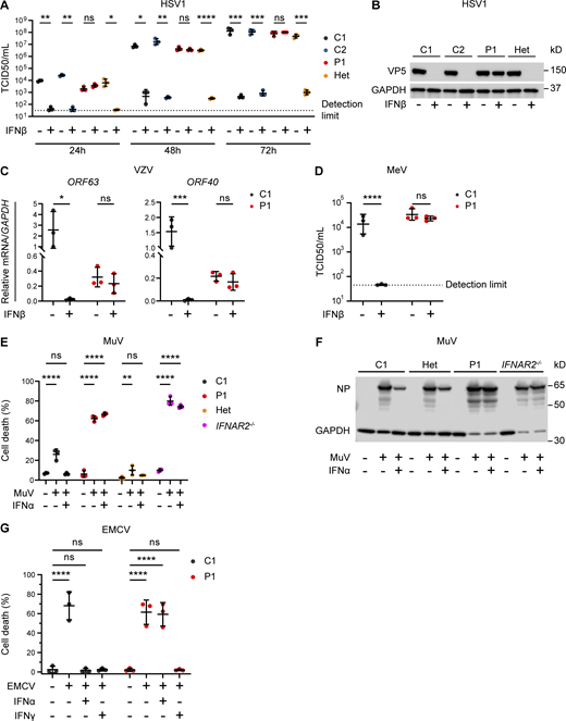 Impaired viral control in patient fibroblasts bearing homozygous IFNAR2 p.Ser53Pro. (A and B) SV40-immortalized dermal fibroblasts from P1, two healthy controls (C1 and C2), and the heterozygous mother of P1 (Het) were pretreated with IFNβ 100 IU/ml for 24 h before infection with HSV1 (KOS strain) at an MOI of 0.001. (A) At 24, 48, and 72 hpi, supernatants were sampled and titrated for TCID50 (geometric mean ± SD of n = 3 independent repeats; *, P < 0.05; **, P < 0.01; ***, P < 0.001; ****, P < 0.0001, two-way ANOVA with Tukey’s test for multiple comparisons). (B) At 72 hpi, the cells were lysed for immunoblotting of whole-cell lysates for the HSV1 protein VP5 and GAPDH as the loading control. One representative immunoblot of n = 3 independent repeat experiments is shown. (C) SV40-immortalized dermal fibroblasts from P1 and a healthy control were pretreated with IFNβ 100 IU/ml for 24 h before infection with cell-free VZV at an MOI of 1. At 48 hpi, total RNA was harvested for RT-qPCR, evaluating the levels of VZV immediate early ORF63 and late ORF40 transcripts, respectively, relative to GAPDH (mean ± SD of n = 3 independent repeats; *, P < 0.05; ***, P < 0.001, two-way ANOVA with Šidák’s test for multiple comparisons). (D) SV40-immortalized dermal fibroblasts from P1 and one healthy control were pretreated with IFNβ 100 IU/ml for 24 h before infection with MeV (Edmonston strain, MOI = 0.00083). At 96 hpi, supernatants were harvested and titrated for TCID50 (geometric mean ± SD of n = 3 independent repeats; ****, P < 0.0001, two-way ANOVA with Tukey’s test for multiple comparisons). (E and F) Primary dermal fibroblasts from P1, a healthy control (C1), the heterozygous mother of P1 (Het) and a known IFNAR2-deficient patient (IFNAR2−/−) were pretreated with IFNα2b 1,000 IU/ml for 16 h before infection with MuV at an MOI 0.1 (MuV, Enders strain). At 72 hpi, (E) viability was assessed in an imaging based live cell viability assay (mean ± SD of n = 3 independent repeats; **, P < 0.01; ****, P < 0.0001, two-way ANOVA with Dunnett’s test for multiple comparisons) and (F) whole cell lysates were prepared for immunoblotting and visualization of MuV nucleoprotein (NP) and GAPDH as loading control. One representative immunoblot of n = 3 independent repeat experiments is shown. (G) Primary dermal fibroblasts from P1 and a healthy control (C1) were pretreated with IFNα2b 1,000 IU/ml for 16 h before infection with a cytopathic dose of EMCV. At 24 hpi, cell viability was assessed in an imaging based live cell viability assay (mean ± SD of n = 3 independent repeats; ****, P < 0.0001, two-way ANOVA with Dunnett’s test for multiple comparisons). Source data are available for this figure: SourceData F3.