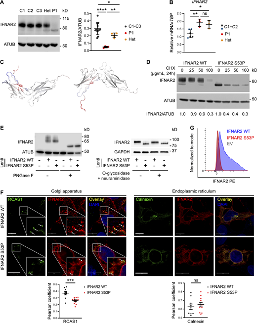 Defective processing of p.Ser53Pro IFNAR2 through the secretory pathway. (A) Primary dermal fibroblasts from P1, healthy controls (C1–3), and the heterozygous mother of P1 (Het) were lysed for immunoblotting of whole cell lysates for IFNAR2 protein and α-tubulin (ATUB) as loading control. Densitometry analysis of IFNAR2 expression relative to loading control (mean ± SD of n = 3 independent experiments; *, P < 0.05; **, P < 0.01; ****, P < 0.0001, Welch’s one-way ANOVA with Dunnett’s test for multiple comparisons). (B) Total RNA from primary dermal fibroblasts from P1, two healthy controls (C1 and C2), and the heterozygous mother of P1 (Het) was purified for RT-qPCR evaluating IFNAR2 mRNA levels relative to TBP (mean ± SD of n = 3 independent experiments; *, P < 0.05; **, P < 0.01, one-way ANOVA with Tukey’s test for multiple comparisons). (C) Model of change to IFNAR2 protein entropy from the p.Ser53Pro substitution, prepared using DynaMUT. Red color indicates a gain of flexibility, blue a gain of stability. (D) HEK 293 FT cells were transfected with HA-tagged expression constructs encoding WT or p.Ser53Pro IFNAR2. 24 h after transfection, the cells were treated with CHX at the indicated concentrations or DMSO vehicle control, for a further 24 h, before whole-cell lysates were prepared for immunoblotting for IFNAR2, and α-tubulin (ATUB) as loading control. Expression of IFNAR2 protein relative to loading control was assessed by densitometry analysis and expressed as a proportion of the DMSO-treated control. Displayed is a representative immunoblot of two independent experiments. (E) Left: HEK293FT cells were transfected with lentiviral expression constructs expressing IFNAR2 WT or IFNAR2 p.Ser53Pro or empty vector. Whole cell lysates were prepared and treated with PNGase F before immunoblotting for IFNAR2 and GAPDH as loading control. Displayed is a representative immunoblot of n = 3 independent experiments. (E) Right: Primary dermal fibroblasts of a healthy control were stably transduced with a lentiviral vector encoding IFNAR2 WT or IFNAR2 p.Ser53Pro. Whole cell protein lysates were harvested and treated with O-glycosidase and neuraminidase before immunoblotting for IFNAR2 and GAPDH as loading control. Displayed is a representative immunoblot of n = 2 independent experiments. (F) HEK293FT cells were transfected with HA-tagged expression constructs encoding WT or p.Ser53Pro IFNAR2. 24 h after transfection cells were fixed, immunostained, and imaged by confocal microscopy for expression of the Golgi marker RCAS1 (left) or the ER marker calnexin (right) alongside IFNAR2. Scale bars represent 10 μm. Shown are the results of correlation analysis of IFNAR2 and the relevant organelle marker in individual cells (mean ± SD of n = 9 WT and n = 12 S53P cells analyzed; ***, P < 0.001, t test). Representative of n = 2 repeat experiments. (G) HEK293FT cells were transfected with HA-tagged expression constructs encoding WT or p.Ser53Pro IFNAR2. 24 h after transfection cell surface expression of IFNAR2 was assessed by flow cytometry. Representative of n = 2 repeat experiments. Source data are available for this figure: SourceData F4.
