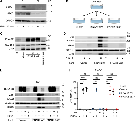 In vitro functional modelling of the IFNAR2 p.Ser53Pro mutant. (A) EBV-transformed B cells from P2 and a healthy control (C1) were treated with IFNα2b 1,000 IU/ml for 30 min. Whole cell lysates were harvested for immunoblotting and visualization of STAT1, pSTAT1 and GAPDH as loading control. Representative of n = 2 repeat experiments. (B) Graphical summary of experimental strategy. IFNAR2-deficient dermal fibroblasts were reconstituted with WT or mutant IFNAR2 lentiviral constructs or an empty vector control. (C) IFNAR2-deficient dermal fibroblasts were reconstituted with WT or mutant IFNAR2 lentiviral constructs or an empty vector control and protein lysates prepared for immunoblotting for IFNAR2, GFP, and GAPDH loading control. Representative of n = 3 independent experiments. (D) IFNAR2-deficient dermal fibroblasts were reconstituted with WT or mutant IFNAR2 lentiviral constructs or an empty vector control. After overnight stimulation with IFNα2b or IFNγ (1,000 IU/ml) protein lysates were prepared for immunoblotting for the ISG products MX1, USP18, RSAD2 and ISG15 alongside GAPDH loading control. Representative of n = 3 independent experiments. (E) Primary IFNAR2-deficient fibroblasts, stably reconstituted with empty vector, WT IFNAR2 or p.Ser53Pro IFNAR2, were pre-treated with IFNα2b or IFNγ (1,000 IU/ml) overnight, prior to infection with HSV1 (17 + strain, MOI 0.01). At 48 h after infection, lysates were prepared for immunoblotting for HSV gD, alongside MX1, RSAD2, ISG15 and GAPDH as loading control. Representative of n = 3 independent experiments. (F) Primary IFNAR2-deficient fibroblasts, stably reconstituted with empty vector, WT IFNAR2 or p.Ser53Pro IFNAR2, were pre-treated with IFNα2b or IFNγ (1,000 IU/ml) overnight, before infection with a cytopathic dose of EMCV. At 24 h after infection, cell viability was assessed in an imaging based live cell viability assay (mean ± SD of n = 3 independent experiments, one-way ANOVA with Šidák’s multiple comparisons test; ****, P < 0.0001; ns, non-significant). Source data are available for this figure: SourceData FS3. Refer to the image caption for details.