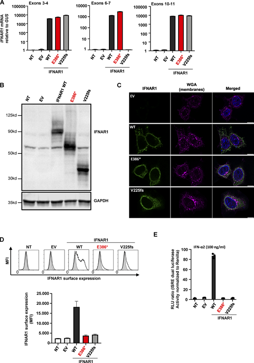The IFNAR1 p.Glu386* variant results in a truncated protein that is not expressed at cell surface and is loss-of-function. (A)IFNAR1 mRNA levels, determined by RT-qPCR, in HEK293T cells transiently transfected with WT or MT IFNAR1 cDNA constructs; β glucuronidase (GUS) was used as an expression control. EV, empty vector; NT, nontransfected; p.V225fs variant from a previously reported IFNAR1−/− patient. Error bars indicate SD. (B) Western blot of IFNAR1 in HEK293T cells transiently transfected with WT and mutant IFNAR1 cDNA constructs. An antibody recognizing the IFNAR1 protein was used. GAPDH was used as a loading control. One blot representative of two independent experiments is shown. (C) Immunofluorescence staining as assessed by confocal microscopy in HeLa cells transiently transfected with IFNAR1 cDNA constructs. An antibody against the N-terminus of IFNAR1 was used (green), and membranes were stained with wheatgerm agglutinin (WGA; purple). The nuclei were stained with DAPI (blue). Scale bar represents 10 µm. The images shown are representative of two independent experiments. (D) Graphical representation of extracellular FACS staining and the mean fluorescence intensity (MFI) for IFNAR1 in HEK293T cells transiently transfected with IFNAR1 cDNA constructs, performed with an antibody recognizing the N-terminus of the protein. Cells were not permeabilized. Results representative of three independent experiments are shown. Error bars indicate the SD. (E) Luciferase activity after IFN-α2 stimulation in IFNAR1−/− HEK293T cells generated with CRISPR/Cas-9 technology and transiently transfected with WT or MT IFNAR1 cDNA constructs. The bars represent the means and SEM of the results obtained in three independent experiments. Ctrl, control; RLU, relative light units. Source data are available for this figure: SourceData F2.