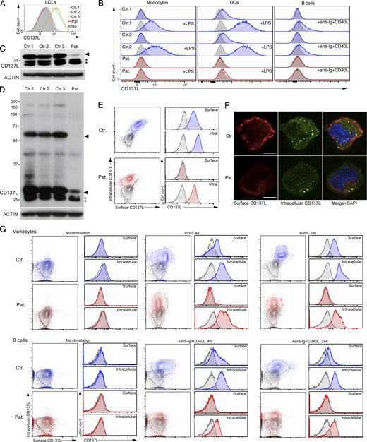 CD137L is expressed in the context of EBV infection and strongly decreased in cells of the patient. (A and B) FACS histograms of CD137L expression. Isotype control in gray. (A) EBV-infected cell lines (LCLs) from the patient (Pat.) and three controls (Ctr.1, Ctr.2, and Ctr.3). (B) Monocytes, differentiated DCs, and B cells activated or not in the presence of LPS for 24 h or anti-Ig + CD40L for 4 h from PBMCs of the patient (Pat., in red) and two healthy controls (Ctr.1 and Ctr.2, in blue). Isotype control in gray. (C and D) WBs of lysates from LCLs lines of panel A, under denaturing (C) and non-denaturating (D) conditions, showing the loss of CD137L expression and dimer formation in the patient. CD137L is indicated by a plain arrowhead and immature/degraded CD137L products by asterisks (*). Anti-ACTIN antibody as the loading control (lower blots). Size markers (in kD) on the left. (E and F) Surface and intracellular CD137L expression in control LCLs (Ctr.) and LCLs of the patient (Pat.). (E) Dot-plots and FACS histograms with Ctr. in blue, Pat. in red, and isotype controls in gray. (F) Fluorescence microscopy of surface (in red) and intracellular (in green) CD137L staining of fixed cells. Merged and DAPI staining in right panels. Magnification ×800, scale, 4 μM. (G) Same as B and E. Surface and intracellular CD137L expression of activated monocytes (upper panels) or B cells (lower panels) for 4 h, 24 h, or not (No stimulation) from a healthy control (Ctr.) and the patient (Pat.). (A) One representative experiment of four. (B) One representative experiment of two. (C and D) One representative experiment of three. (E) One representative experiment of two. (F) Images representative of one cell among >20 analyzed cells. Source data are available for this figure: SourceData F3. Refer to the image caption for details.