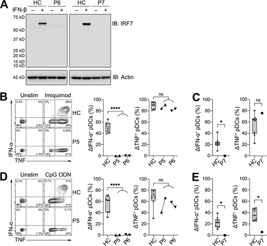 Patients with the newly discovered IRF7 variants do not produce IRF7 protein or IFN-α upon pDC stimulation. (A) Protein levels for IRF7 in PBMCs with and without IFN-β stimulation for 24 h; comparison of patients and healthy controls (HC). Actin staining was used as a loading control. Representative immunoblots (IB) from single independent experiments per patient are shown. (B and C) Frequency of IFN-α– and TNF-producing pDCs (live Lin–CD11c–HLA-DR+CD303+CD123+) after 6 h of stimulation with imiquimod for fresh (B) and thawed (C) PBMCs. (D and E) Frequency of IFN-α– and TNF-producing pDCs (live Lin–CD11c–HLA-DR+CD303+CD123+) after 6 h of stimulation with CpG ODN for fresh (D) and thawed (E) PBMCs. For P5 and P6, cells were assessed at two independent time points 6 mo apart. (A–E) All data are presented as the frequency of responding cells minus the frequency of the corresponding unstimulated controls. Box plots are bound by the 25th and 75th percentiles. The median is marked, and the whiskers indicate the minimum and maximum. Individual values are plotted. Unpaired t tests were performed to compare healthy controls (HC; n = 8–9) with patients. *, P < 0.05; ****, P < 0.0001. Source data are available for this figure: SourceData F3. Refer to the image caption for details.