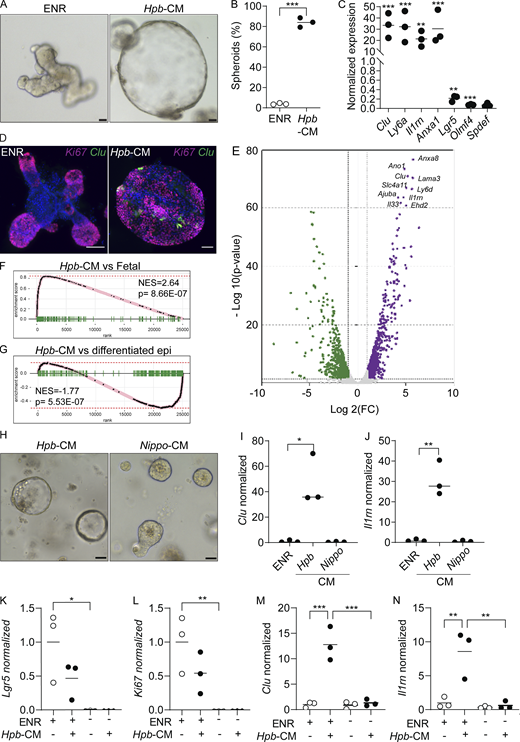 Hpb-CM directly induces fetal reversion of intestinal organoids. (A) SI organoids were stimulated with ENR (control) or Hpb-CM medium for 24 h after 3 d in culture. (B) Frequency of organoids with a spheroid morphology. (C) qPCR analysis of SI organoids stimulated with Hpb-CM for 24 h from the plating of fresh crypts. (D) Confocal photomicrographs of SI organoids from CluGFP crypts (Ayyaz et al., 2019) stimulated with Hpb-CM for 24 h on day 3 of culture. (E) Volcano plot of differentially expressed genes from RNA-seq analysis comparing Hpb-CM–treated organoids to control organoids, false discovery rate < 0.05. For a complete list of differentially expressed genes, see Table S1. (F and G) GSEA of fetal-associated transcripts (F) and differentiated epithelial cell markers (G). NES, normalized enrichment score. (H–J) Representative photomicrographs (H) and qPCR analysis (I and J) of SI organoids stimulated with Nippo-CM for 24 h. (K–N) qPCR analysis of SI established organoids stimulated with Hpb-CM for 24 h in the presence or absence of ENR. Scale bar, 50 μm. Data shown are representative of two or more independent experiments, n = 3 biological replicates; statistical tests: t test (B, C, I, and J), two-way ANOVA (K–N); *, P < 0.05; **, P < 0.01; ***, P < 0.005.