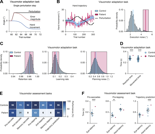 PAX5 deficiency of the patient causes impaired motor control and learning. (A–D) Visuomotor adaptation task (Video 1). (A) Schematic illustration of the hand movement angles and error angle magnitudes during a single adaptation step. As the movement angle approaches the inverse of the perturbation angle, the error magnitude decreases. In other words, participants compensate with their movements for the perturbation by minimizing the magnitude of the end-point error. (B) Visuomotor adaptation task. Hand movement traces of the patient (red) and a representative control (blue) during adaptation to the perturbation (black line). Right: Estimated execution noise (ε) parameters. 95% credible interval (CI) of the patient (red; σε = 4.81, 95% CI 4.35–5.36) shown against the distribution of the controls (mean in blue; σε = 2.02, 95% CI 1.90–2.14; n = 60). (C) Parameter estimates of the retention rate, learning rate, and planning noise, respectively. The patient’s mean value and 95% CI are shown in red (retention rate = 0.98, 95% CI 0.97–0.99; learning rate = 0.11, 95% CI 0.07–0.18; planning noise = 0.43, 95% CI 0.24–0.99). The mean value of the control group (n = 60) is shown in blue. The blue bars represent the density distribution for all controls. (D) Mean reaction and movement times of controls (blue; n = 60) and patient (red) across all trials. The reaction time was defined as the time from the appearance of the target until movement initiation. The movement time was defined as the time from movement initiation until movement end. (E) Data summary of the visuomotor assessment tasks (Video 2). Performance matrix of the indicated tasks is shown for the patient and controls (n ≥ 7) with percentage of correct trials, using the mean value of the controls. (F) Visuomotor assessment tasks. Time reflecting eye and hand latency of the patient and controls (n ≥ 9) during the pro-saccade, pro-tapping, and trajectory prediction trials, respectively (Video 2). Two-tailed one-sample t test (D and F); **, P < 0.01; ****, P < 0.0001. For detailed statistical information (D and F), see Table S6. Each dot represents one individual (D and F).