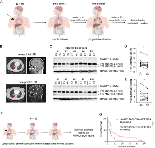 nANGPTL4 levels decrease in melanoma patients in the transition from stable to progressive disease. (A) Schematic representation of patient status at time point A (stable disease) and B (progressive disease). The primary melanoma is colored in black. Micrometastases are multicolored, and macrometastases are colored in black. The figure was generated with BioRender.com. (B) Representative MRI images of melanoma patients with either stable or progressive disease status. Arrows are pointing toward metastatic areas which are progressing from stable disease (SD) to progressive disease (PD). (C) Western blotting with an nANGPTL4-specific antibody in serum samples of melanoma patients with either stable or progressive disease status. Densitometry quantitation of protein levels on Western blot was performed with Fiji. (D and E) The graphs show the level of ANGPTL4 (D) and NT1/ANGPTL4 ratio (E) normalized to transferrin in patients’ sera with either stable disease or progressive disease diagnosis (n = 10). *, P < 0.05, two-tailed paired Student’s t test. (F) Schematic representation of patient status during longitudinal serum collection. The primary melanoma and macrometastases are colored in black. The figure was generated with BioRender.com. (G) Kaplan–Meier plot showing the survival of patients with an increasing or decreasing nANGPTL4/FL ratio. Survival is given as months after the second serum sample was taken (time point B). n = 15–17; *, P < 0.05, log-rank (Mantel–Cox) test. Source data are available for this figure: SourceData F2.
