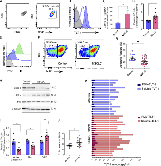 The platelet purity, gating strategy, and human NSCLC platelet assays. (A) Representative contour or pseudocolor plots for gating strategy (left) and platelet purity (CD41+) are shown for FC assays performed on washed platelets. (B) The FC histogram overlay showing washed platelets stained with anti–TLT-1 (solid blue) or its isotype control (unfilled blue) and the unstained control sample in solid gray. (C) The quantitation (mean ± SEM) of TLT-1–relative mRNA normalized to β-tubulin in individual samples. Statistical significance tested by Mann–Whitney test. (D) Quantitation of total TLT-1 platelet expression by Western blot. Statistical significance tested by Mann–Whitney test. (E) The FC histograms overlay for positive control for PAC1 marker where washed healthy platelets were stained for PAC1 after activation with ADP (green) or without any external stimulation (blue). The signal from unstained platelets is shown in gray. The events (30,000) were acquired at low flow rate and data analyzed by FlowJo. (F and G) Representative FC pseudocolor plots of washed platelets from NSCLC patients and controls show the NAO-stained platelets where NAO-ve population represents ex vivo apoptotic platelets with their quantitation (G; n = 15 for control and n = 24 for NSCLC). The assay measures the loss of mitochondrial integrity by measuring NAO fluorescence loss from platelets. Statistical significance tested by Mann–Whitney test. (H and I) Representative Western blot–based analysis (H) of total platelet expression of activated Caspase 3, Bax, and Bcl2 proteins in NSCLC and control and their quantitation (I) normalized to loading control. The band densities were measured by ImageJ software and normalized to β-tubulin (loading control). (J) Quantitation of PMV expressing TLT-1 as measured by FC. Statistical significance tested by Mann–Whitney test. (K) ELISA-based comparison of quantitation of TLT-1 in isolated microvesicle fraction versus soluble fraction representing microvesicle-depleted plasma. Each bar represents one patient or control sample as indicated. The data in this figure are presented as FC histograms or as vertical bars with either individual values (in K), or with mean ± SEM. Significant differences are indicated with asterisks (*, P < 0.05; **, P < 0.01; ***, P < 0.001) and correspond to two-tailed non-parametric Mann–Whitney test. The data represent a minimum of three independent experiments. Source data are available for this figure: SourceData FS1. Refer to the image caption for details.