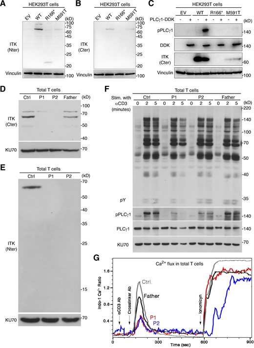 Analysis of ITK expression and function. (A–C) Studies of ITK alleles in an overexpression system. (A and B) Immunoblotting of the ITK protein with two different mAbs. (C) Phosphorylation of phospholipase C-γ1. (D and E) Immunoblotting for endogenous ITK protein with two different antibodies, on total T lymphocytes from P1, P2, their father, and one healthy control (Ctrl). (F) TCR signaling assay. Total T lymphocytes from P1, P2, their father, and one healthy control were analyzed by immunoblotting for general tyrosine phosphorylation (pY) and for the phosphorylation of phospholipase C-γ1 without stimulation or after 2 or 5 min of stimulation with anti-CD3 mAb. (G) Calcium (Ca2+) influx assay. Total T lymphocytes from P1, P2, their father, and one healthy control were stimulated by TCR crosslinking (with anti-CD3 and anti-IgG mAbs) or ionomycin. Intracellular Ca2+ concentration was determined with Indo-1. Representative results from at least two independent experiments are shown. Source data are available for this figure: SourceData F2. Refer to the image caption for details.