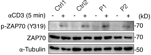 Phosphorylation of ZAP70. Total T lymphocytes from P1, P2, and two healthy controls (Ctrl) were analyzed by immunoblotting for phosphorylated ZAP70 (Y319) after 5 min of stimulation with anti-CD3 mAb. A representative result from two independent experiments is shown. Source data are available for this figure: SourceData FS3.