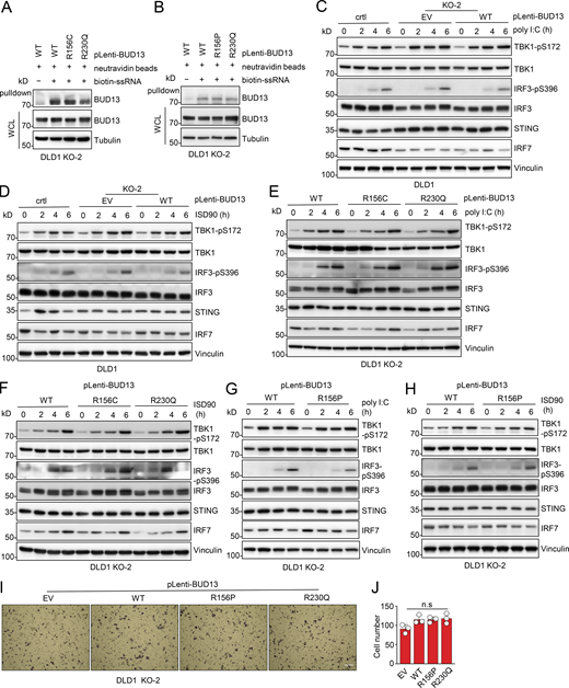 BUD13-R156C mutation is not deficient in RNA binding and innate immunity. (A and B) IB analysis of biotin-RNA pulldowns and WCL derived from indicated DLD1 cells. (C–H) IB analyses of WCL derived from indicated DLD1 cells transfected with either 5 mg/ml ISD90 or 5 mg/ml poly I:C for indicated time periods before cell collection. (I and J) Representative images for transwell assays using 1 × 105 DLD1 cells for 24 h and quantified in J. Scale bar represents 5 µm. Statistical analysis was performed using one-way ANOVA. n.s. shows no significance between indicated groups. All the data are representative of three independent experiments (error bars, mean ± SD). Source data are available for this figure: SourceData FS3. Refer to the image caption for details.