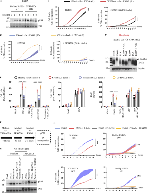 CF airway epithelial cells show exacerbated sensitivity to EXOA-driven pyroptosis, which is reversed by ZAKα inhibition. (A) Immunoblotting of P38 and phosphorylated P38 in pHNECsWT and pHNECsCF from healthy (WT) and CF patients exposed to EXOA (10 ng/ml) or not for 8 h. Immunoblots show lysates from one experiment performed at least two times. (d1) stands for donor 1 from CF or healthy (WT) patients. Images shown are from one experiment and are representative of n = 2 independent experiments. (B and C) Plasma membrane permeabilization determination over time using PI incorporation in pHNECsWT or pHNECsCF exposed to EXOA (10 ng/ml) for indicated times. When specified, SB203580, an inhibitor of P38 activity (10 µM) or PLX420 (bRaf, ZAKα inhibitor, 10 µM) were used. (d1) and (d2) stand for donors 1 or 2, respectively. ***P ≤ 0.001, T test. Values are expressed as mean ± SEM from one experiment (in triplicate) from one independent donor (d1/d2, CFd1/CFd2) performed at least three times. (D) Phosphotag blotting of phosphorylated ZAKα in pHNECsWT and pHNECsCF from healthy (WT) and CF patients exposed to EXOA (10 ng/ml) or not for 8 h. When specified, PLX420 (bRaf, ZAKα inhibitor, 10 µM) was used. Immunoblots show lysates from one experiment performed at least two times. (d2) stands for donor 2 from CF or healthy (WT) patients. Images shown are from one experiment and are representative of n = 3 independent experiments. (E) Cell lysis (LDH) and IL-18 release evaluation in pHNECsWT and pHNECsCF upon EXOA (10 ng/ml), anisomycin (1 µg/ml), or VbP (15 µM) treatment for 18 h in presence/absence of PLX420 (ZAK inhibitor, 10 µM). ***P ≤ 0.001, T test. Values are expressed as mean ± SEM from one experiment (in triplicate) from one independent donor (d1/d2, CFd1/CFd2) performed at least three times. (F) Graphical representation of CFTR correctors Ivacaftor (10 µM), Tezacaftor (10 µM), and Elexacaftor (5 µM) (TRIKAFTA) treatment to CF cells. (G) Immunoblotting of P38 and phosphorylated P38 in pHNECsCF treated or not for 72 h with TRIKAFTA and exposed to EXOA (10 ng/ml) or anisomycin (1 µg/ml) for 6 h. Immunoblots show lysates from one experiment performed at least two times. When specified, PLX420 (bRaf, ZAKα inhibitor, 10 µM) was used. Immunoblots show lysates from one experiment performed at least two times. (d3) stands for donor 3 from CF patients. (H) Plasma membrane permeabilization determination over time using PI incorporation in pHNECs or pHNECsCF in the presence/absence of TRIKAFTA and subsequently exposed to EXOA (10 ng/ml) for indicated times. When specified, PLX420 (bRaf, ZAKα inhibitor, 10 µM) was used. (d3) and (d4) stand for donors 3 or 4, respectively. ***P ≤ 0.001, T test. Values are expressed as mean ± SEM from one experiment (in triplicate) from one independent donor (d3/d4, CFd3/CFd4) performed at least three times. Source data are available for this figure: SourceData F4. Refer to the image caption for details.