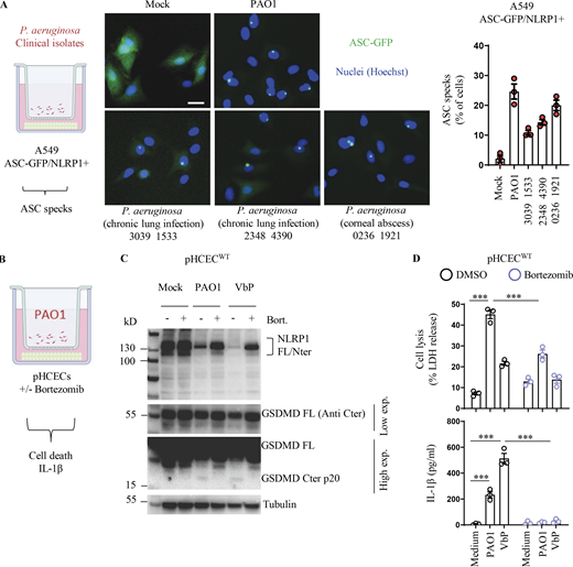 P. aeruginosa–activated hNLRP1 inflammasome requires proteasome activity. (A) Fluorescence microscopy and associated quantifications of ASC-GFP specks in A549NLRP1+/ASC-GFP reporter cell lines exposed to 1 × 105P. aeruginosa clinical isolates from patients with infected lung (strains 3039 1533 and 2348 4390) or with infected cornea (strain 0236 1921) for 24 h. ASC-GFP (green) pictures were taken in the dish after infection. Images shown are from one experiment and are representative of n = 3 independent experiments; scale bars, 10 µm. ASC complex percentage was performed by determining the ratios of cells positive for ASC speckles on the total nuclei (Hoechst). At least 10 fields from each experiment were analyzed. Values are expressed as mean ± SEM. One-way ANOVA. (B) Schematic drawing of P. aeruginosa co-culture experiments performed with human corneal epithelial cells. (C) Immunoblotting of NLRP1, Gasdermin-D, and Tubulin in pHCECs upon VbP (15 µM) treatment or P. aeruginosa (PAO1, 1.105 bacteria) co-culture for 24 h in presence/absence of proteasome inhibitor bortezomib. Immunoblots show lysates from one experiment performed at least three times. (D) Cell lysis (LDH) and IL-1B release evaluation in pHCECs and pHNECs, upon VbP (15 µM) treatment or P. aeruginosa (PAO1, 1.105 bacteria) co-culture for 24 h in presence/absence of proteasome inhibitor bortezomib. ***P ≤ 0.001, two-way ANOVA with multiple comparisons. Values are expressed as mean ± SEM from one experiment (in triplicate) performed at least three times. Source data are available for this figure: SourceData FS1.