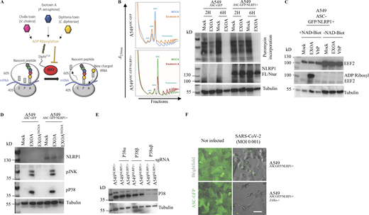 Multiple EEF2-targeting toxins activate the hNLRP1 inflammasome in a ZAKα-dependent manner. (A) Schematic mechanism of EXOA and related toxin-mediated translation inhibition. tRNA, transfer RNA; E, exit; P, peptidyl; A, aminoacyl. (B) Determination of ribosome inactivation in A549NLRP1+/ASC-GFP and A549NLRP1−/ASC-GFP reporter cell lines exposed to EXOA (10 ng/ml) for 2 and 6 h by measuring ribosome polysome accumulation and puromycin incorporation. Images are representative of one experiment performed at least three times. (C) Immunoblotting of ADP-ribosylated proteins, EEF2, and Tubulin in A549NLRP1+/ASC-GFP cell lysates treated or not with VbP (15 µM) or EXOA (10 ng/ml) in the presence of Nicotinamide adenine dinucleotide-Biotin (NAD-Biot). Immunoblots show lysates from one experiment performed at least three times. (D) Immunoblotting of NLRP1, Tubulin, and phosphorylated P38 and JNK in A549NLRP1+ and A549NLRP1− reporter cell lines exposed or not to EXOA (10 ng/ml) or its inactive mutant EXOAH426A for 3 h. Immunoblots show lysates from one experiment performed at least three times. (E) Immunoblotting characterization of genetic invalidation of P38α and P38β in A549NLRP1+/ASC-GFP cells using CRISPR-Cas9. Immunoblots show lysates from one experiment performed at least three times. (F) Fluorescence microscopy of ASC-GFP specks in A549NLRP1+/ASC-GFP and A549NLRP1+/ASC-GFP/ZAKα- reporter cell lines expressing hACE2 infected for 24 h with various SARS-CoV-2 MOI. ASC-GFP (green) pictures were taken in the dish after viral infection. Images shown are from one experiment and are representative of n = 3 independent experiments; scale bars, 10 µm. Source data are available for this figure: SourceData FS2. Refer to the image caption for details.