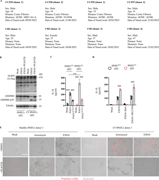 CF cells show exacerbated sensitivity to undergo cell death upon ribotoxic stress. (A) Information regarding healthy and CF patient samples used in this study. (B) Immunoblotting of NLRP1, Gasdermin-D (GSDMD), and Tubulin in pHNECsWT and pHNECsCF from healthy (WT) and CF patients exposed to EXOA (10 ng/ml) or not for 12 h in presence or absence of PLX420 (ZAKα inhibitor, 10 µM). Immunoblots show combined supernatants and lysates from one experiment performed at least three times. (d2) stands for donor 2 from CF or healthy (WT) patients. Immunoblots show lysates from one experiment performed at least two times. (C) IL-18 release in pHNECsWT and pHNECsCF co-cultured with PAO1 or PAO1ΔEXOA (1.105 bacteria) for 24 h. ***P ≤ 0.001, T test. Values are expressed as mean ± SEM from one experiment (in triplicate) from one independent donor (d2, CFd2) performed at least three times. (D) IL-18 release evaluation in pHNECsWT and pHNECsCF upon EXOA (10 ng/ml), treatment for 18 h in presence/absence of Bortezomib (Bort., proteasome inhibitor, 1 µM) or MCC950 (NLRP3 inflammasome inhibitor, 10 µM). ***P ≤ 0.001, T test. Values are expressed as mean ± SEM from one experiment (in triplicate) from one independent donor (d2, CFd2) performed at least two times. (E) Fluorescence microscopy of PI (red) incorporation into pHNECWT (donor 2) and pHNECCF (donor 1) after exposure to anisomycin or EXOA for 16 h in presence or not of the ZAKα inhibitor PLX4720 (10 µM). Images shown are from one experiment and are representative of n = 3 independent experiments; scale bars, 50 µm. Source data are available for this figure: SourceData FS3. Refer to the image caption for details.