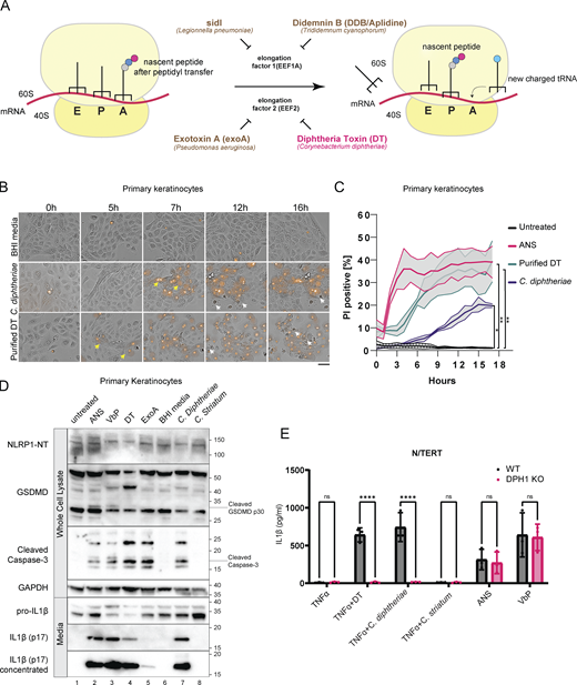 C. diphtheriae, DT, and exoA activate pyroptosis in primary keratinocytes. (A) Simplified cartoon representation of eukaryotic ribosome translocation and EEF1/EEF2-targeting toxins. E, exit; P, peptidyl; A, aminoacyl. (B) Live cell imaging of primary keratinocytes treated with BHI media, sterile filtrates of C. diphtheriae grown in iron-restricted media or recombinant DT (150 ng/ml). The concentration of DT in C. diphtheriae media was normalized to ∼150 ng/ml. Brightfield images were overlaid with PI fluorescence (red). Images were taken at 20× magnification. Images are representative of three independent experiments. Distinct cell death morphology is marked by yellow arrows (pyroptosis, PI+ve cells with membrane swelling) and white arrows (apoptosis, cell shriveling). Only select representative cells are marked. Scale bar represents 100 μm. (C) Quantification of the percent of PI+ve cells over time in B. Error bars represent three biological replicates, with each drug treatment considered as one replicate. Significance values were calculated from Student’s t test at the 7-h time point. *, P ≤ 0.05. **, P ≤ 0.01. (D) Immunoblot of inflammasome activation markers in primary keratinocytes 24 h after treatment. ANS (1 µM); VbP (1 µM); DT (150 ng/ml), exoA (1 µg/ml). Cells in lane 6 were incubated with BHI broth, while lanes 7 and 8 were incubated with sterile-filtered C. diphtheriae or C. striatum conditioned BHI media. Immunoblot is representative of three replicate experiments. (E) IL-1β ELISA from TNFα-primed wild-type or DPH1 KO N/TERT culture media. Media were harvested 18 h after treatment. Significance values were calculated from one-way ANOVA with multiple group comparisons, from three biological replicates. ns, not significant. ****, P ≤ 0.0001. Source data are available for this figure: SourceData F1.