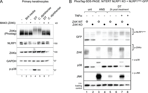 DT and C. diphtheriae trigger RSR downstream of EEF2 inactivation. (A) Immunoblot of ZAKα, p38 NLRP1 in primary keratinocytes treated with the indicated triggers in the presence of DMSO or M443 (1 µM). M443 was added 10 min before DT or bacterial filtrate. Lysates were harvested 3 h after treatment. Immunoblot representative of three replicate experiments. (B) Immunoblot of RSR kinases and GFP-NLRP1linker in control and ZAKα KO N/TERT cells. ANS-treated cells were harvested 2 h after treatment. Indicated cells were primed with 25 ng/ml TNFα overnight and then treated with 150 ng/ml DT. Immunoblot representative of three replicate experiments. Source data are available for this figure: SourceData F2. Refer to the image caption for details.