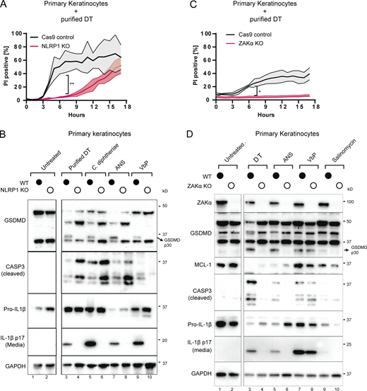 DT and C. diphtheriae cause pyroptosis in a ZAKα and NLRP1-dependent manner but also cause other forms of cell death. (A) Comparison of PI uptake kinetics between control and NLRP1 KO primary keratinocytes in response to purified DT. Error bars represent three biological replicates, with each drug treatment considered as one replicate. Significance values were calculated from Student’s t test at the 7-h time point. **, P ≤ 0.01. (B) Immunoblot of GSDMD, cleaved caspase-3, and IL-1β in WT and NLRP1 KO keratinocyte lysates or media 24 h after the indicated treatment. Immunoblot is representative of three replicate experiments. (C) Comparison of PI uptake kinetics between control and ZAKα KO primary keratinocytes in response to purified DT. Error bars represent three biological replicates, with each drug treatment considered as one replicate. Significance values were calculated from Student’s t test at the 7-h time point. *, P ≤ 0.05. (D) Immunoblot of ZAKα, GSDMD, MCL-1, cleaved caspase-3 and IL-1β in WT and ZAKα KO keratinocyte lysates or media 24 h after the indicated treatment. Salinomycin (10 µM) does not activate the NLRP1 inflammasome and was used as a negative control. Immunoblot is representative of three replicate experiments. Source data are available for this figure: SourceData F3. Refer to the image caption for details.