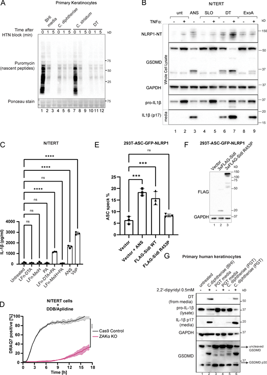 Additional data on the effect of EEF2 targeting bacterial toxins, including DT. (A) Anti-puromycin immunoblot of primary keratinocytes subjected to the harringtonine run-off assay. Cells were treated with BHI media, sterile filtrates of C. diphtheriae, C. striatum for 6 h, or purified DT (150 ng/ml) for 3 h before harringtonine addition (2 µg/ml). Nascent peptides were then labeled with 10 µg/ml puromycin for 10 min at different intervals. (B) Immunoblot of inflammasome components NLRP1, GSDMD, and IL-1β in N/TERT with and without TNFα priming (25 ng/ml, 8 h). Streptolysin O (SLO, 1 µg/ml) was included as additional negative control. (C) IL-1β ELISA of culture media from N/TERT cells treated with the indicated recombinant proteins or compounds. LFn (150 ng/ml): Lethal Factor from B. anthracis (aa 34–288). PA (300 ng/ml). MxiH: Shigella flexneri type 3 secretion needle protein. All cells were primed with TNFα. Significance values were calculated from one-way ANOVA with multiple group comparisons. Error bars derived from data from three technical replicates. The graph represents one of two biological replicates. (D) Kinetics of PI uptake in unprimed N/TERT cells treated with DDB/Aplidine. Significance values were calculated from Student’s t test at 4 h. Error bars are derived from data from three technical replicates. Data represent one of two biological replicates. (E) The percentage of cells with ASC-GFP specks among 293T-ASC-GFP-NLRP1 cells transfected with the indicated plasmids. Cells were fixed 24 h after transfection. ASC-GFP specks were visualized using GFP epifluorescence and normalized to the total number of cells per field of view using DAPI nuclear counterstain. Error bars are derived from data from three technical replicates. Data represent one of two biological replicates. (F) Immunoblot of overexpressed 3xFLAG-sidI and R453P glycolysase-defective mutant. Note that the level of wild-type sidI is much lower than the R453P mutant due to its strong inhibitory effect on translation, as reported previously by Subramanian et al. (2022)Preprint. (G) Immunoblot of inflammasome activator markers GSDMD and IL-1β in primary keratinocytes treated with the indicated bacterial filtrate. C. diphtheriae was cultured in BHI broth and PGT media (see Materials and methods). ***, P ≤ 0.001; ****, P ≤ 0.0001. Source data are available for this figure: SourceData FS1.