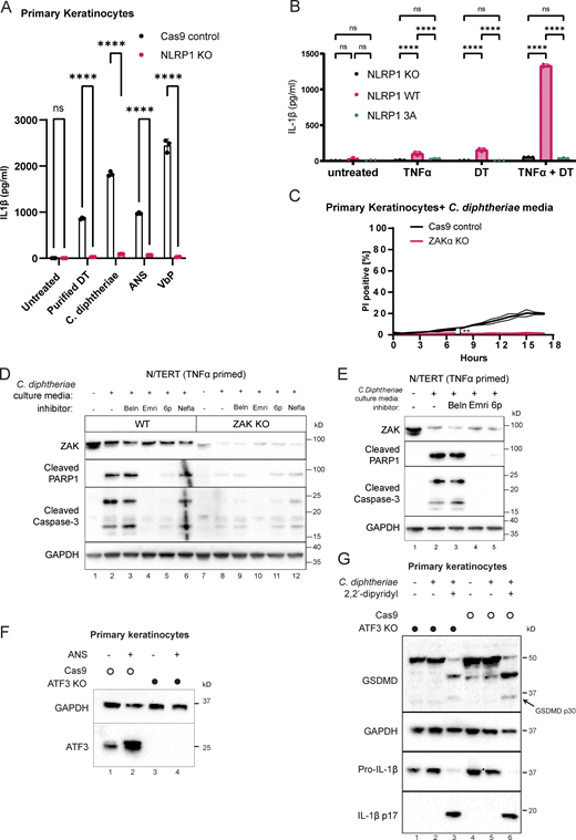 Additional characterization of NLRP1 phosphorylation, ZAKα, and ATF3 in DT-induced pyroptosis and apoptosis. (A) IL-1β ELISA from control and NLRP1 KO human primary keratinocytes. Media were harvested 18 h after treatment. Purified DT (150 ng/ml). ANS (1 µM). VbP (3 µM). (B) IL-1β ELISA from NLRP1 KO N/TERT cells rescued with wild-type NLRP1 or NLRP1 3A mutant primed or treated with the indicated conditions. TNFa priming 18 h, media harvested 18 h later after treatment. (C) Kinetics of PI uptake for control and ZAKα KO primary keratinocytes. Error bars are derived from data from three technical replicates. Data represent one of two biological replicates. Significance values were calculated from Student’s t test at the 7-h time point. (D) Immunoblot of apoptotic markers (cleaved caspase-3 and PARP1) from the lysates of TNFα-primed N/TERT cells treated with C. diphtheriae BHI media filtrate and the indicated inhibitors. Beln: caspase-1 inhibitor belnacasan (5 µM). Emri: pan-caspase inhibitor emricasan (5 µM). 6p (0.5 µM). (E) Immunoblot of apoptotic markers from the lysates of TNFα-primed WT and ZAKα KO N/TERT cells treated with C. diphtheriae BHI media filtrate and the indicated inhibitors. Beln: caspase-1 inhibitor belnacasan (5 µM). Emri: pan-caspase inhibitor emricasan (5 µM). 6p (0.5 µM). Nefla: p38 inhibitor neflammapimod (0.5 µM). (F) ATF3 immunoblot in control and ATF3 KO primary keratinocytes. Lysates were harvested 3 h after ANS. (G) Immunoblot of GSDMD and IL-1β comparing inflammasome activation of Cas9 control and ATF3 KO keratinocytes treated with C. diphtheriae media (normalized to ∼150 ng/ml DT). ns, not significant; **, P ≤ 0.01; ****, P ≤ 0.0001. Source data are available for this figure: SourceData FS2. Refer to the image caption for details.