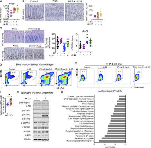 IL-22 reduced pathology during intestinal inflammation. (A) Gene expression level of antimicrobial peptide Reg3γ in the intestine on day 10 of the C57BL/6 mice challenged with 2.5% DSS for the first 6 d and treated with rIL-22 starting from day 3 to day 10. (B) Representative images of Ki67 staining and quantitative data showing Ki67+ve staining increase with rIL-22 treatment in DSS mice. (C) Representative PAS-AB staining and Ki67 staining, blind histological scoring for goblet cell volume, and relative expression of ER stress marker Grp78 in the distal colons of Winnie mice treated with or without rIL-22 on alternative days for 2 wk prior to cull at day 14. (D) Flow cytometric plots and data shown as a % of CD45+, Cd11b+ MHC II+ BMDMs from WT animals in the presence of IFNγ and IL-22 alone or in combination (n = 3). (E) Flow cytometric plots and MHC II+ve cells shown as a percentage of live/dead THP1 cells treated with IFNγ and IL-22 alone or in combination. (F) Colon weight/length ratio of naïve Il22ra1 fl/fl (Il22ra1WT) and CMV-cre × Il-22ra1 fl/fl (Il22ra1KO) mice. (G) Cell signaling activation markers were measured by Western blot analysis in intestinal organoids from WT animals with and without IL-22 (rIL-22, 100 ng/ml for 30 min). (H) DAVID gene ontology analysis of RNA-Seq data shows a downregulation of pathways associated with ER stress, inflammation in WT mice treated with IL-22 (rIL-22, 100 ng/ml for 4 h). Data are representative of three independent experiments and are presented as mean ± SEM (n = 4–12). One-way ANOVA, Bonferroni’s post hoc test; *P < 0.05, **P < 0.01. ##P < 0.01, ####P < 0.0001 compared to untreated WT controls. Source data are available for this figure: SourceData FS2.