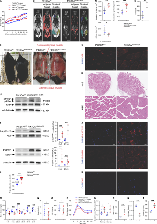 A mouse model of PIK3CA-related skeletal muscle overgrowth. (A) Male and female body weights of PIK3CAWT and PIK3CAHSA-CreER (n = 15 per group) mice following Cre recombination. (B) Coronal whole-body T2-weighted magnetic resonance images of PIK3CAWT and PIK3CAHSA-CreER mice. Scale bar: 1 cm. (C) Adipose tissue and skeletal muscle volume quantification. (D) Strength measured using grip test (n = 3 per group). (E) Representative pictures of PIK3CAWT and PIK3CAHSA-CreER mice. Scale bar: 1 cm. (F) Western blot of p110α and GFP in skeletal muscles of PIK3CAWT and PIK3CAHSA-CreER mice (n = 3 per group). (G) Representative GFP immunofluorescence in skeletal muscles of PIK3CAWT and PIK3CAHSA-CreER mice. Scale bar: 10 μm. (H) Representative H&E staining of striated muscles of PIK3CAWT and PIK3CAHSA-CreER mice. Scale bar: 20 μm. (I) Western blot of P-AKTSer473, total AKT, P-S6RP, and S6RP in skeletal muscles of PIK3CAWT and PIK3CAHSA-CreER mice and quantification at 8 and 24 wk of age (n = 5–10 mice per group). (J) Representative immunofluorescence of P-AKTThr308 and P-S6RP in skeletal muscle of PIK3CAWT and PIK3CAHSA-CreER mice. Scale bar: 10 μm. (K) Representative immunofluorescence of KI67 in skeletal muscle of PIK3CAWT and PIK3CAHSA-CreER mice. Scale bar: 10 μm. (L) Quantification of skeletal muscle cell area of PIK3CAWT and PIK3CAHSA-CreER mice (n = 5 mice per group). (M) 12-h fasted glycemia in PIK3CAWT and PIK3CAHSA-CreER mice (n = 5–13 mice per group). (N) Insulin circulating levels in PIK3CAWT and PIK3CAHSA-CreER mice (n = 10 per group). (O) Circulating IGF-1 levels in PIK3CAWT and PIK3CAHSA-CreER mice (n = 10–11 per group). (P) Oral tolerance test (GTT) in PIK3CAWT and PIK3CAHSA-CreER mice (n = 6 mice per group). (Q) 18F-FDG uptake in skeletal muscle of PIK3CAWT and PIK3CAHSA-CreER mice (n = 4 per group). (R–T) (R) TMRE, (S) Mitotracker, and (T) 10 NAO staining in skeletal muscle of PIK3CAWT and PIK3CAHSA-CreER mice (n = 4 per group). Data are shown as mean ± SEM. *P < 0.05, **P < 0.01, ***P < 0.001 (two-tailed unpaired t test). Each dot represents one mouse. Data are representative of at least two independent experiments. Of note, all blots from this figure originate from the same gel. Source data are available for this figure: SourceData F2. Refer to the image caption for details.