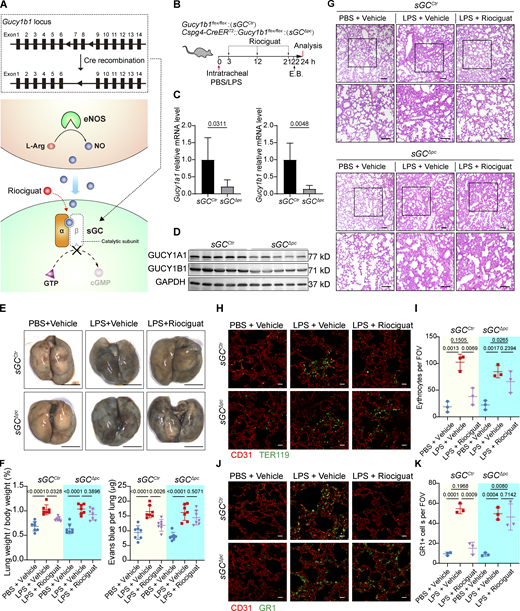 Pericyte-specific sGC deletion abrogates Riociguat's therapeutic effect. (A) Schematic diagram depicting the conditional inactivation of sGC signaling by Cre mediated deletion of exon7-8 of Gucy1b1. (B) Schematic illustration depicting the Riociguat treatment in the PBS/LPS instilled Gucy1b1flox/flox (sGCCtr) and Cspg4-CreERT2::Gucy1b1flox/flox (sGCΔPC, pericyte-specific sGC inactivation). E.B.: Evans blue. (C) qPCR validation of the Gucy1a1 and Gucy1b1 mRNA levels in the lungs of sGCCtr and sGCΔPC mice. Data are presented as mean ± SD, n = 5 mice per group. (D) Western blot of GUCY1A1 and GUCY1B1 protein levels in the lungs of sGCCtr and sGCΔPC mice. (E) Macro images of the lungs of Evans blue–perfused sGCCtr and sGCΔPC mice treated with PBS, LPS, or LPS + Riociguat. Scale bar: 5 mm. (F) Quantification of the amount of leaked Evans blue in the lungs and the lung weight/body weight ratio of sGCCtr and sGCΔPC mice treated with PBS, LPS, or LPS + Riociguat. Data are presented as mean ± SD, n = 7 mice. (G) Representative images of H&E stained lung sections of sGCCtr and sGCΔPC mice treated with PBS, LPS, or LPS + Riociguat. Scale bar: 100 μm. (H) Representative fluorescence images showing CD31 and TER119 stained lung sections of sGCCtr and sGCΔPC mice treated with PBS + vehicle, LPS + vehicle, or LPS + Riociguat. Scale bar: 20 μm. (I) Quantification of TER119-positive erythrocytes in the lung section per FOV. Data are presented as mean ± SD, n = 3 mice. (J) Representative fluorescence images showing CD31 and GR1 stained lung sections of sGCCtr and sGCΔPC mice treated with PBS + vehicle, LPS + vehicle, or LPS + Riociguat. Scale bar: 20 μm. (K) Quantification of GR1-positive neutrophils in the lung section per FOV. Data are presented as mean ± SD, n = 3 mice. Statistical significance was determined by two-tailed Student’s t test (C) or one-way ANOVA with Tukey test (F, I, and K). Source data are available for this figure: SourceData F4.