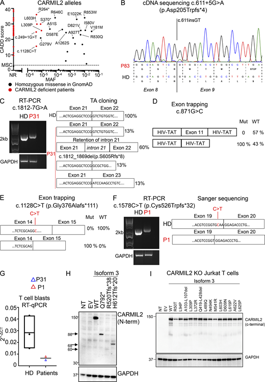 In vitro validation of CARMIL2 variants. (A) CADD score (y axis) plotted against MAF (x axis) for the homozygous variants present in the gnomAD database (http://gnomad.broadinstitute.org). The variants found in gnomAD and tested functionally are annotated in black, and the mutations confirmed in CARMIL2-deficient patients are annotated in red. MSC, mutation significance cutoff; NR, not reported. (B) Total mRNA was extracted from the T cell blasts of P83 and a HD, amplified with RT-PCR, and subjected to Sanger sequencing. (C) Total mRNA was extracted from the T cell blasts of a HD and P31, and subjected to RT-PCR, followed by TA cloning. PCR amplification of the CARMIL2 cDNA is shown, with GAPDH cDNA as a positive control. (D) Exon-trapping experiments were conducted for the c.871G>C allele. Control genomic DNA was inserted into the pspl3 plasmid (WT) and subjected to site-directed mutagenesis to obtain the c.871G>C-encoding plasmid (Mut). Total mRNA was extracted from COS-7 cells transfected with the WT and Mut plasmids and subjected to RT-PCR. PCR amplification of the CARMIL2 cDNA, with aberrant splicing detected in 100% of the screened colonies. HIV-Tat are exons from the pspl3 plasmid. N = 1. (E) Exon-trapping was performed on genomic DNA extracted from the T cell blasts of a HD and P4 (c.1128C>T) and subjected to TA cloning. Schematic representation of the PCR products, showing abnormal splicing in 100% of the screened colonies, relative to control cells. (F) Total mRNA was extracted from the T cell blasts of a HD and P1 (c.1578C>T) and subjected to RT-PCR. PCR amplification and Sanger sequencing of the CARMIL2 cDNA showed an aberrant product in P1. N = 1. (G) Total mRNA was extracted from the T cell blasts of three HDs, P1, and P31. Total mRNA was subjected to RT-qPCR for the assessment of total CARMIL2 expression. Data are displayed as 2−ΔCt values after normalization according to endogenous GUS control gene expression. The bar represents the mean value in controls. N = 1. (H) Western blot analysis of CARMIL2 levels in total cell extracts from HEK293T cells transfected with a pcDNA3.1 plasmid, either empty (EV) or containing WT isoform 3 (WT), or mutant forms found in CARMIL2-deficient patients. Two Abs were used: an Ab against the N-terminus of CARMIL2, and an Ab against GAPDH. The data shown are representative of two independent experiments. (I) Western blot analysis of CARMIL2 levels in total cell extracts from non-transduced CARMIL2 KO Jurkat T cells, or after transduction with an empty lentivirus (EV), a lentivirus encoding WT isoform 3 (WT), or the missense and in-frame deletion variants identified in CARMIL2-deficient individuals (N = 2). Source data are available for this figure: SourceData FS1.