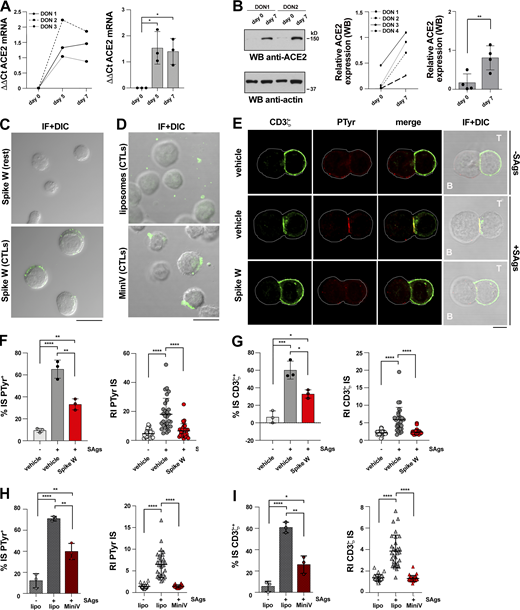 Spike suppresses TCR accumulation and phosphotyrosine signaling at the CTL IS. (A and B) RT-qPCR of human ACE2 mRNA (A) and immunoblot analysis of human ACE2 protein (B) in purified CD8+ T cells prior to stimulation (day 0) or after stimulation with anti-CD3/CD28 mAb–coated beads in the presence of IL-2 for the indicated times. The migration of molecular mass markers is indicated (n = 3, one-way ANOVA test for RT-qPCR analysis; *, P ≤ 0.05; n = 4, paired two-tailed Student’s t test for immunoblot analysis; **, P ≤ 0.01). (C) Immunofluorescence analysis of Spike W binding to purified CD8+ T cells prior to stimulation (day 0) or 7 d after stimulation with anti-CD3/CD28 mAb–coated beads in the presence of IL-2 (n = 2). Scale bar, 15 μm. (D) Immunofluorescence analysis of CTL binding of fluorescently labeled MiniVs (Spike W embedded in fluorescent NDP-labeled liposomes) or control liposomes. Representative images are shown (n = 2). Scale bar, 15 μm. (E–G) Immunofluorescence analysis of CD3ζ and PTyr in CTLs (day 7) pretreated with either vehicle (PBS) or 0.05 μg/μl Spike W (cell viability after pretreatment 91.7 ± 0.2%), mixed with Raji cells (APCs) either unpulsed or pulsed with a combination of SEA, SEB, and SEE (SAgs), and incubated for 15 min at 37°C. Representative images (medial optical sections) of the T cell:APC conjugates are shown (E). Scale bar, 5 μm. (F) Left: Quantification (%) of 15-min SAg-specific conjugates harboring PTyr staining at the IS (≥50 cells/sample, n = 3, one-way ANOVA test; ****, P ≤ 0.0001; **, P ≤ 0.01). Right: Relative PTyr fluorescence intensity at the IS (recruitment index; 10 cells/sample, n = 3, Kruskal–Wallis test; ****, P ≤ 0.0001). (G) Left: Quantification (%) of 15-min SAg-specific conjugates harboring CD3ζ staining at the IS (≥50 cells/sample, n = 3, one-way ANOVA test; ***, P ≤ 0.001; *, P ≤ 0.05). Right: Relative CD3ζ fluorescence intensity at the IS (recruitment index; 10 cells/sample, n = 3, Kruskal–Wallis test; ****, P ≤ 0.0001). (H and I) Immunofluorescence analysis of CD3ζ and PTyr in CTLs (day 7) pretreated with either 1.2 × 109 control liposomes or MiniVs, mixed with Raji cells (APCs) either unpulsed or pulsed with a combination of SEA, SEB, and SEE (SAgs), and incubated for 15 min at 37°C. (H) Left: Quantification (%) of 15-min SAg-specific conjugates harboring PTyr staining at the IS (≥50 cells/sample, n = 3, one-way ANOVA test; ****, P ≤ 0.0001; **, P ≤ 0.01). Right: Relative PTyr fluorescence intensity at the IS (recruitment index; 10 cells/sample, n = 3, Kruskal–Wallis test; ****, P ≤ 0.0001). Side-by-side comparison of PTyr+ immune synapses formed by CTLs pretreated with the same amount of soluble and MiniV-associated Spike showed a ∼2.3-fold increase in the suppressive ability of Spike when associated with MiniVs (51 vs. 22%, n = 3). (I) Left: Quantification (%) of 15-min SAg-specific conjugates harboring CD3ζ staining at the IS (≥50 cells/sample, n = 3, one-way ANOVA test; ****, P ≤ 0.0001; **, P ≤ 0.01; *, P ≤ 0.05). Right: Relative CD3ζ fluorescence intensity at the IS (recruitment index; 10 cells/sample, n = 3, Kruskal–Wallis test; ****, P ≤ 0.0001). Nonsignificant differences are not shown. Source data are available for this figure: SourceData F1.